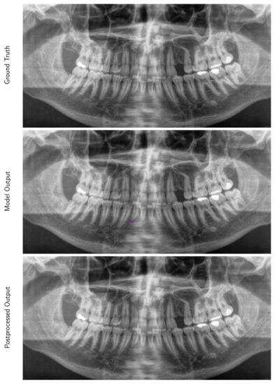 Diagnostics 10 00430 g0a4