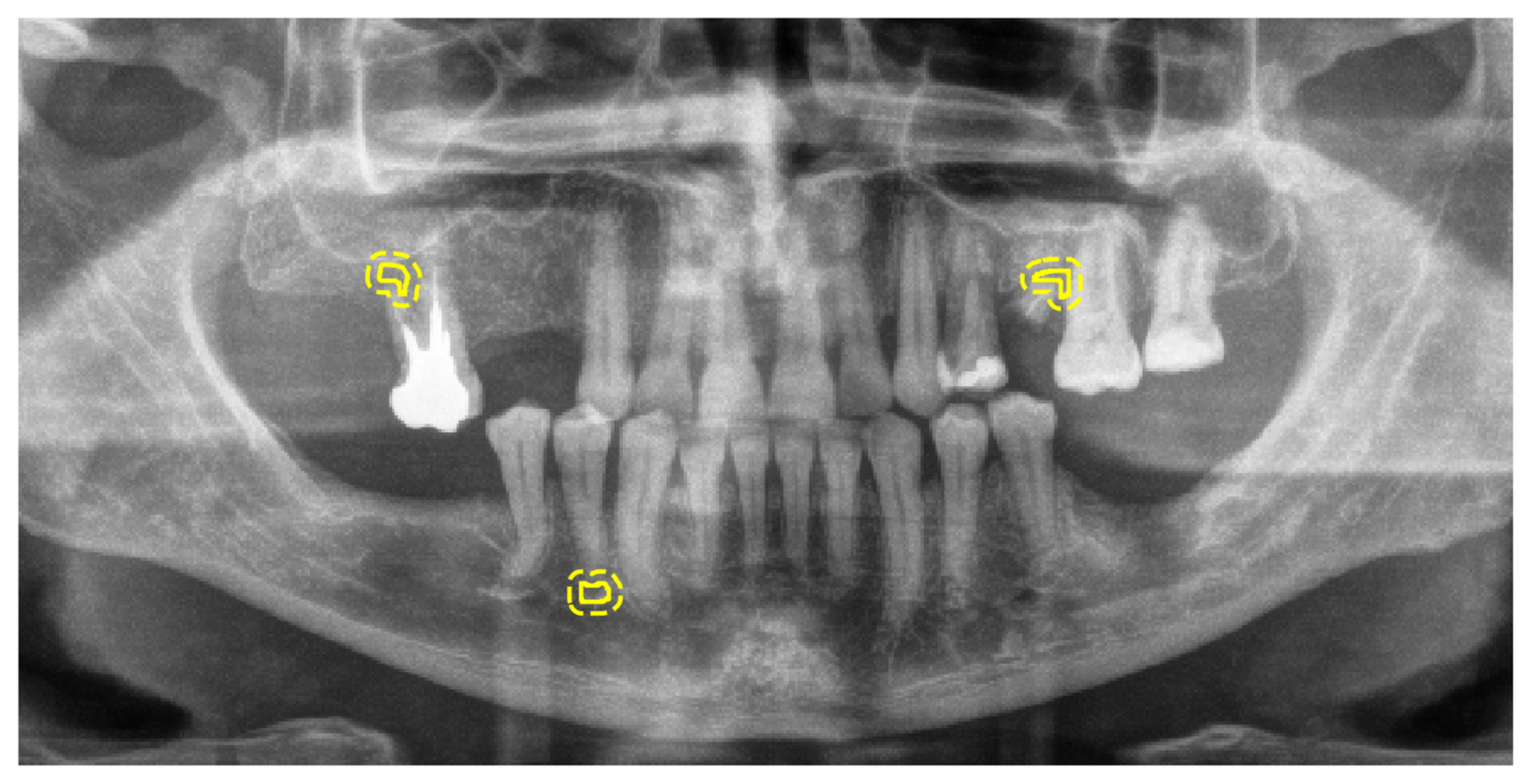 Diagnostics 10 00430 g0a5