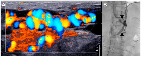 Diagnostics 10 00432 g001 550