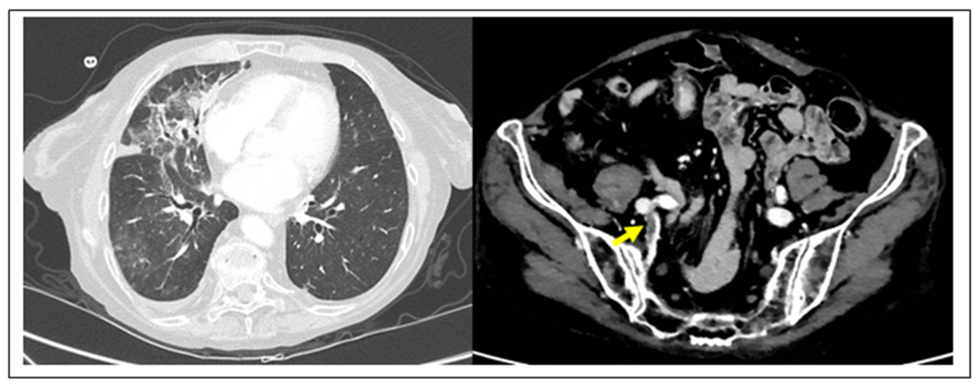 Diagnostics 10 00440 g001