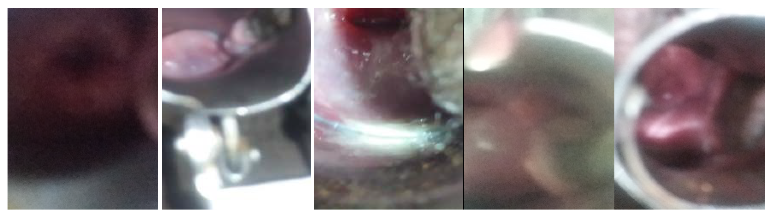 Diagnostics 10 00451 g008