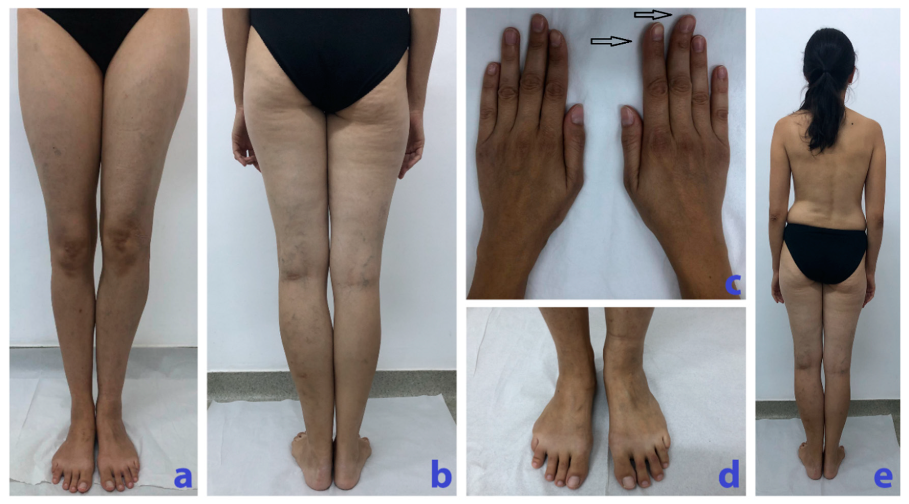 Diagnostics 10 00467 g001 Diagnostics 10 00467 g001