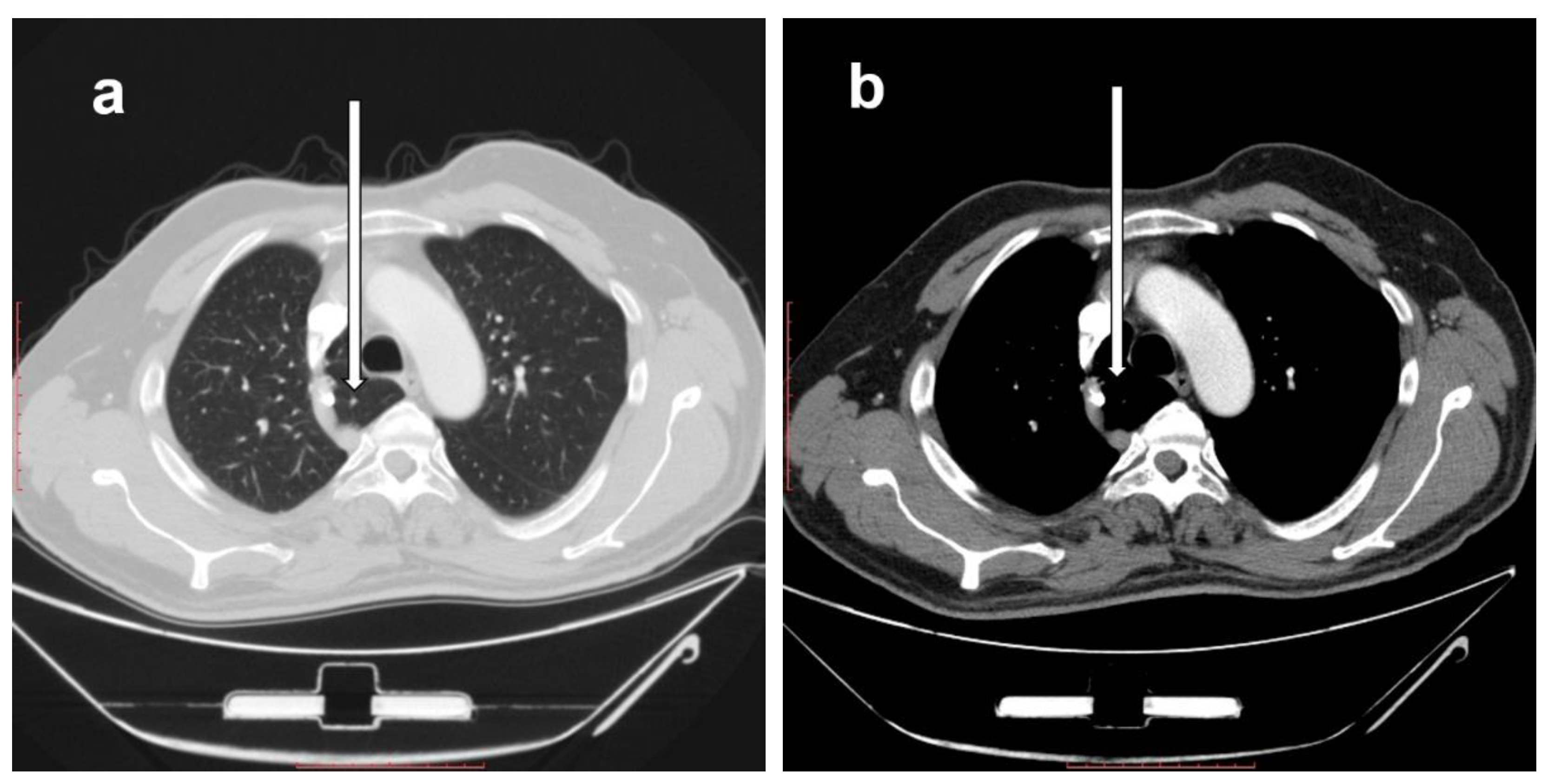 Diagnostics 10 00470 g001