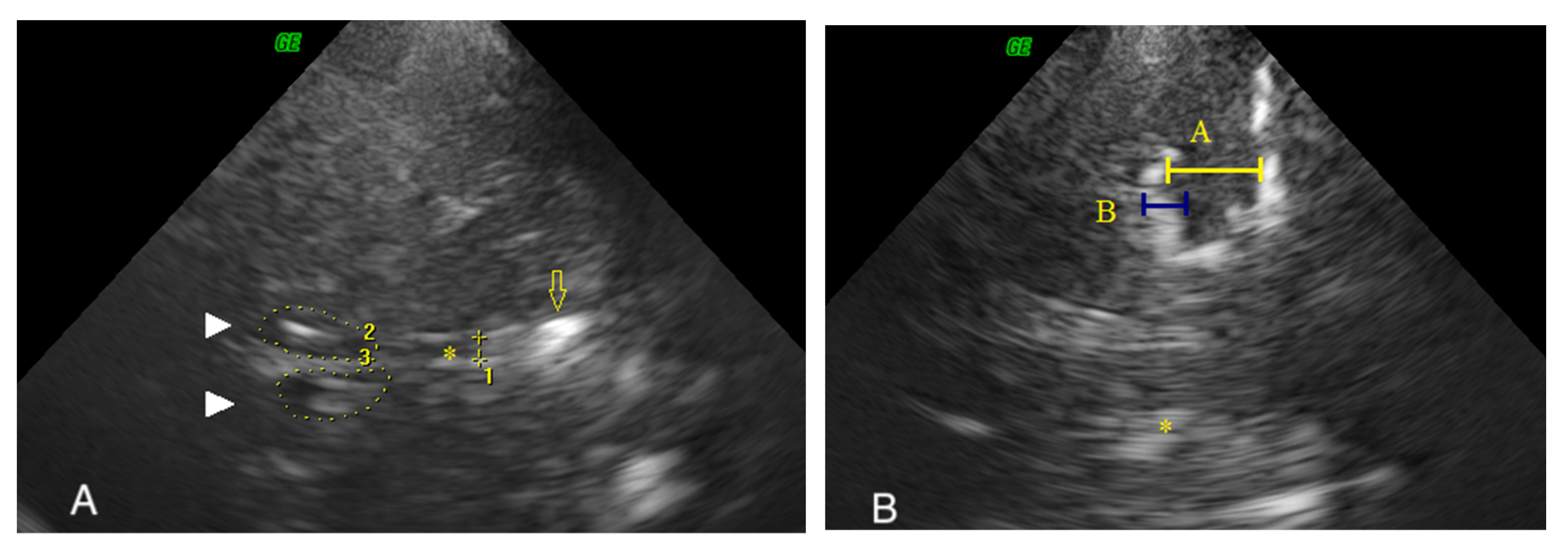 Diagnostics 10 00471 g002 Diagnostics 10 00471 g002