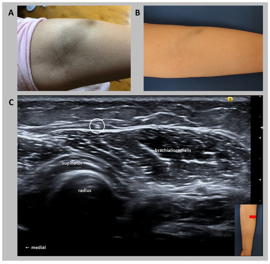 Diagnostics 10 00516 g001