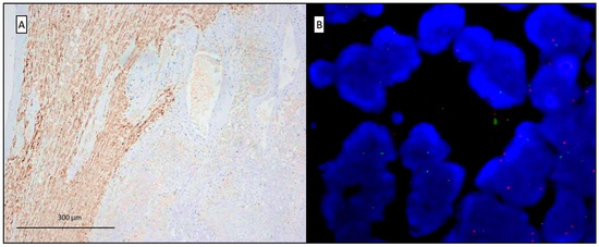 Diagnostics 10 00555 g003