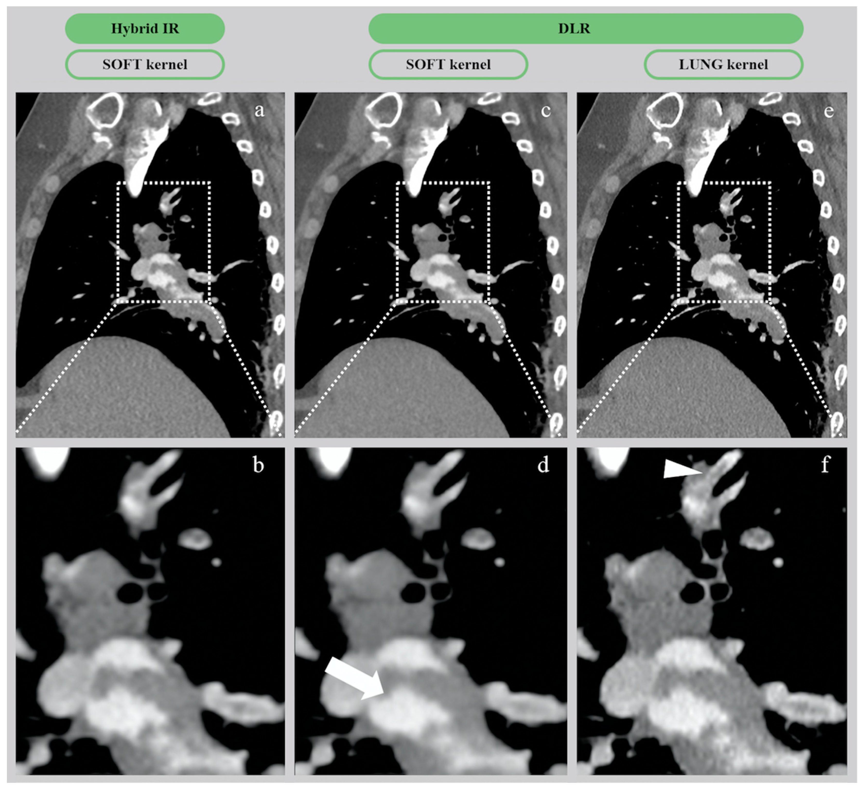 Diagnostics 10 00558 g006