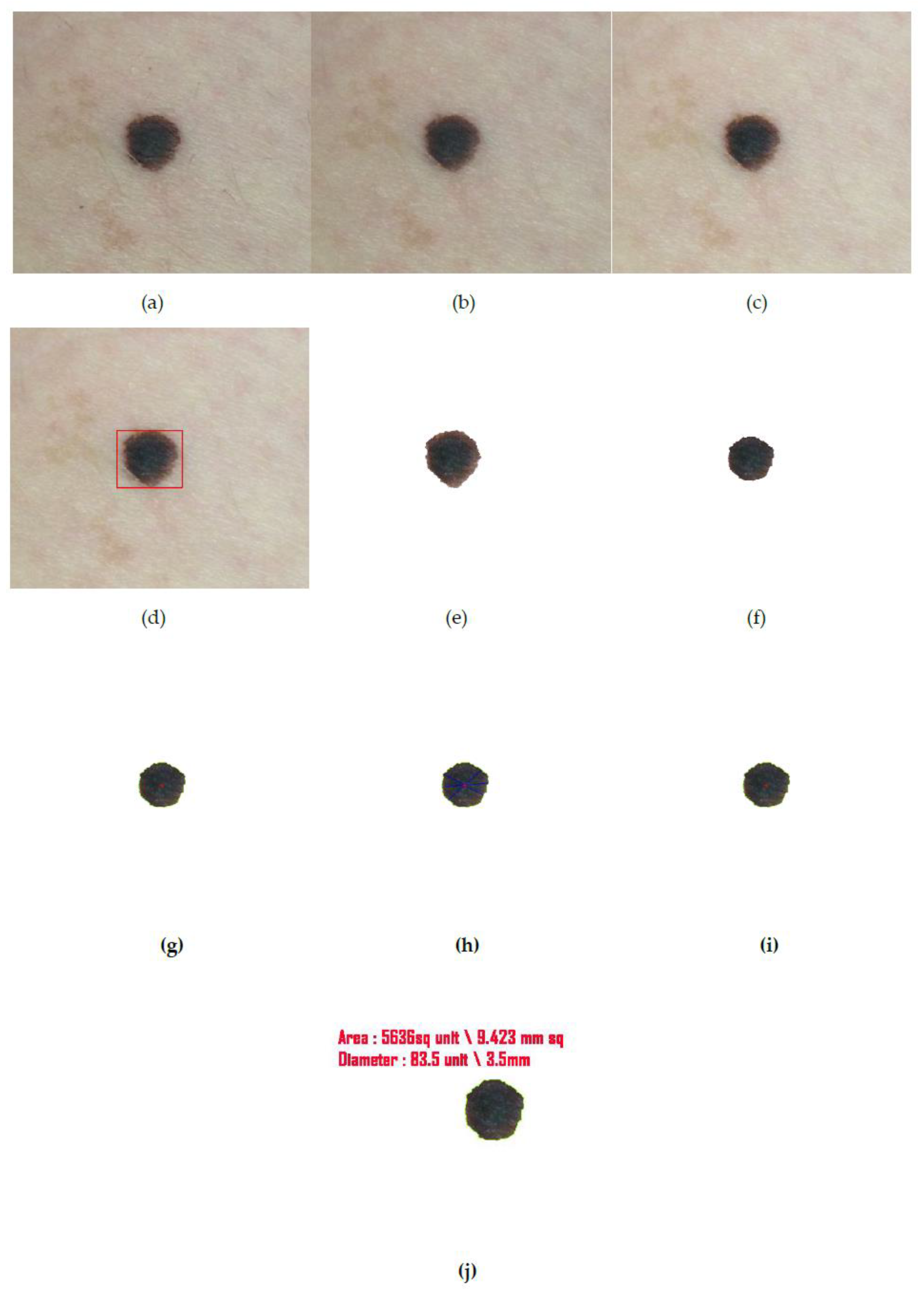 Diagnostics 10 00577 g015