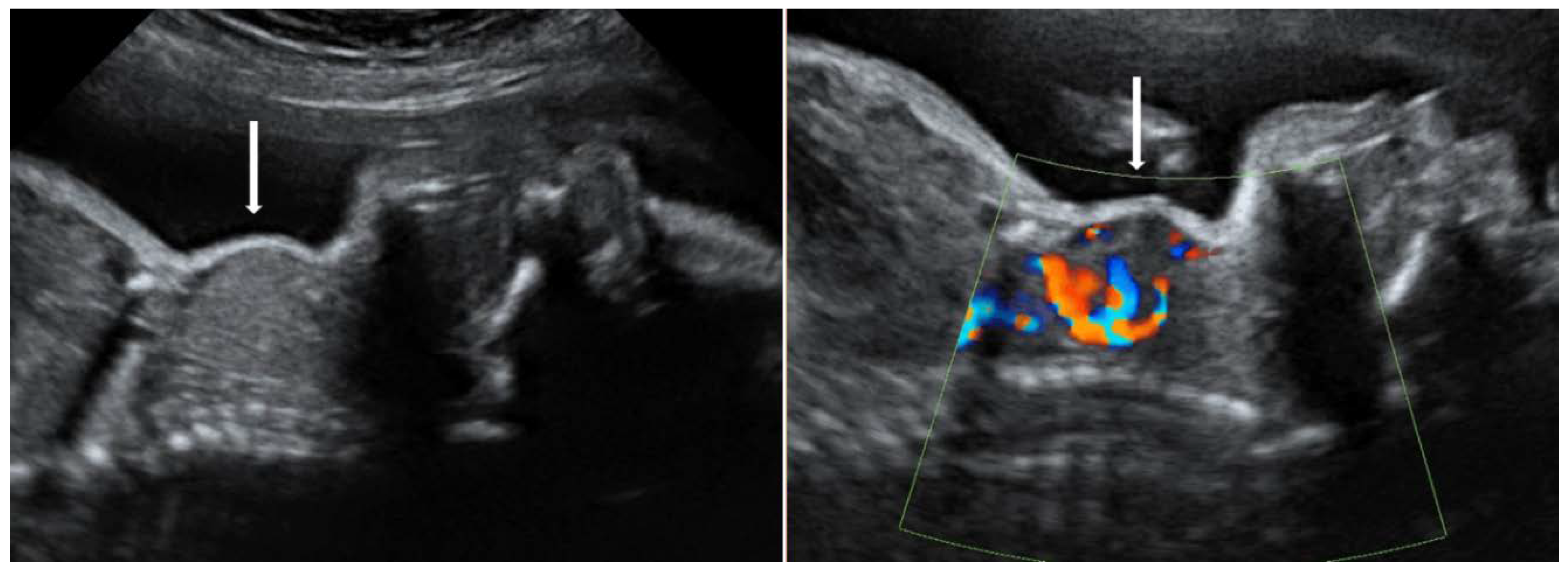 Diagnostics 10 00583 g003