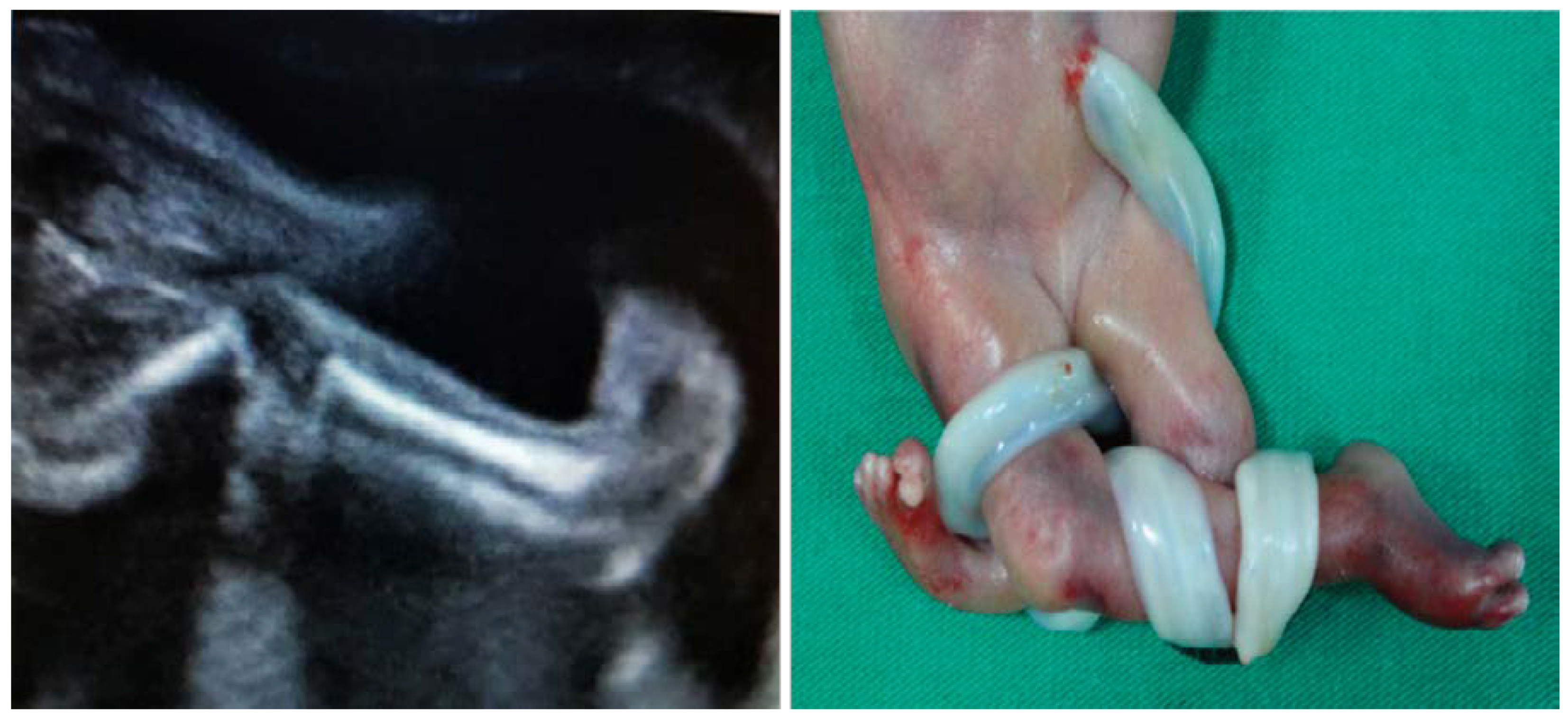 Diagnostics 10 00583 g004