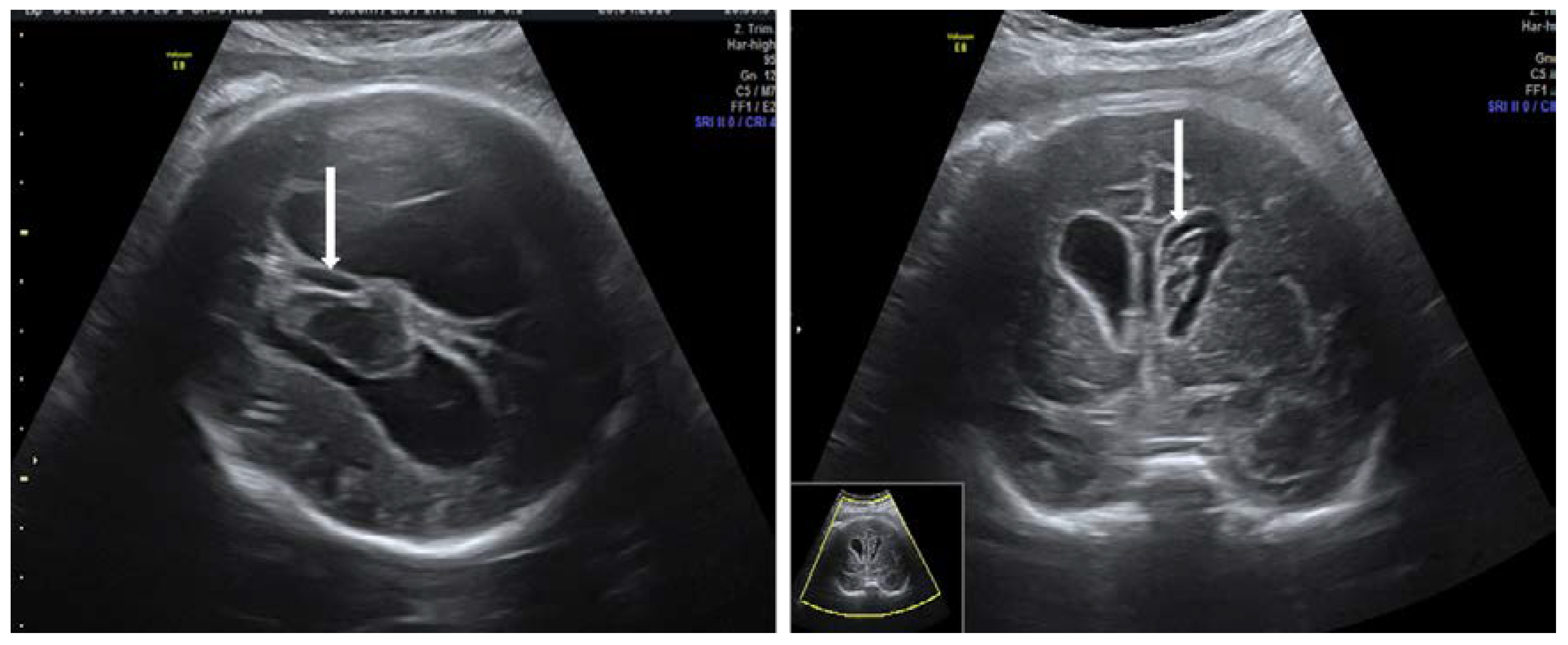 Diagnostics 10 00583 g007