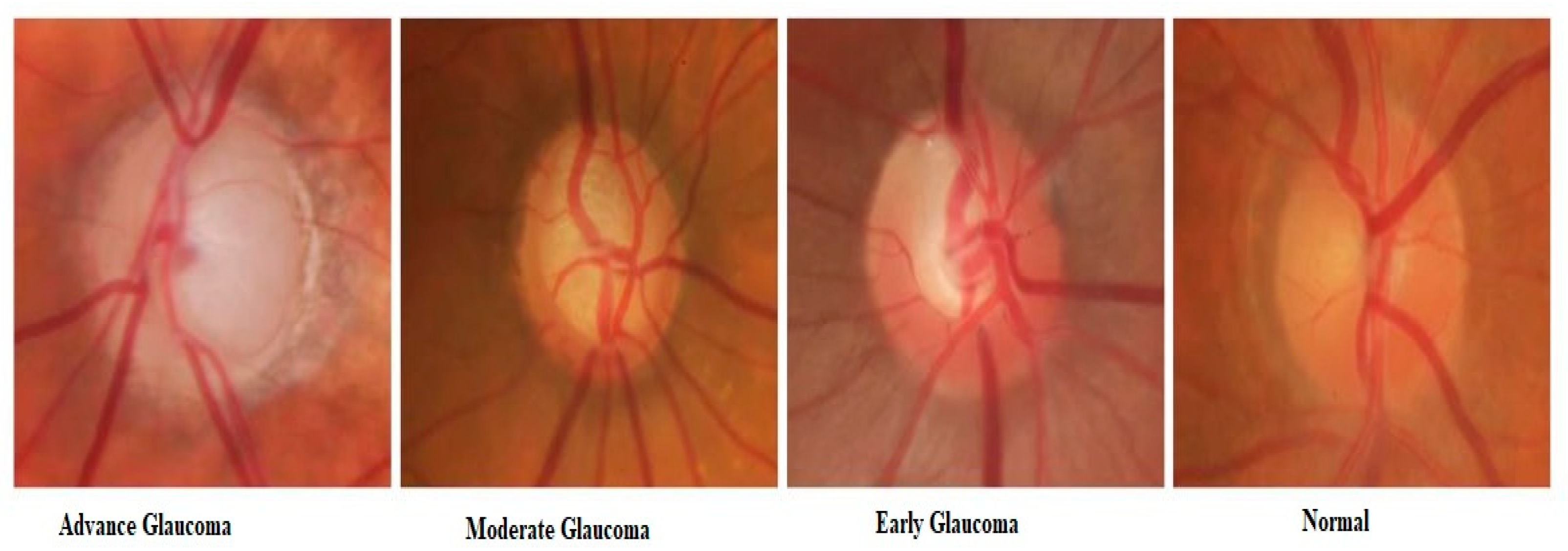 Diagnostics 10 00602 g005 Diagnostics 10 00602 g005