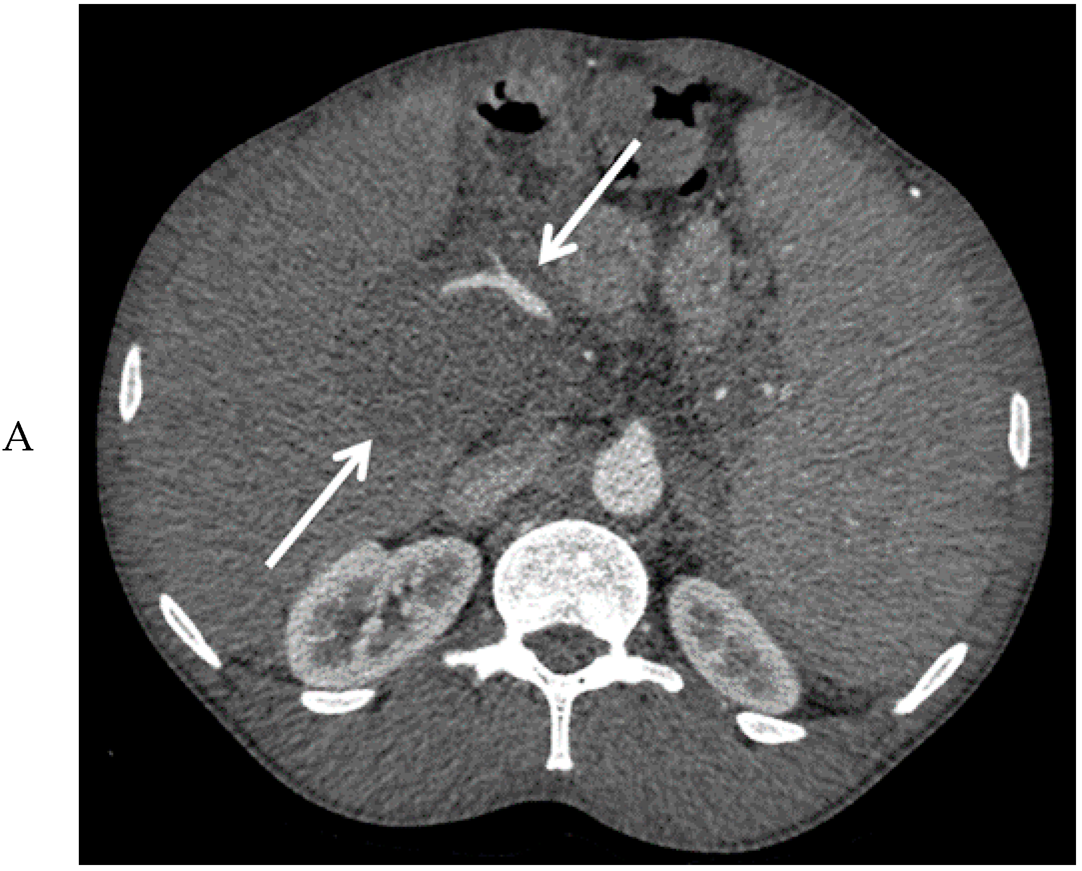 Diagnostics 10 00623 g002a Diagnostics 10 00623 g002a