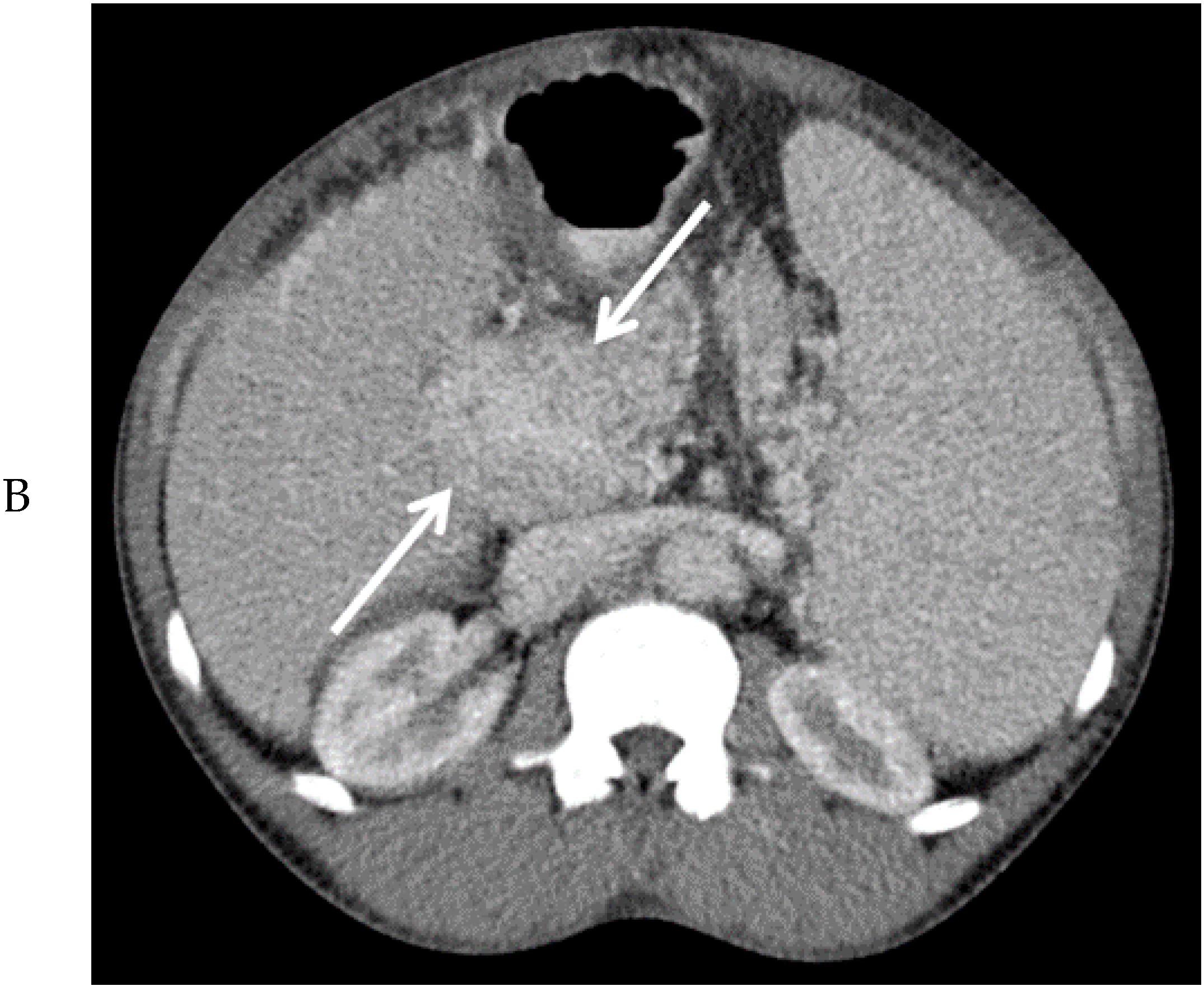 Diagnostics 10 00623 g002b Diagnostics 10 00623 g002b