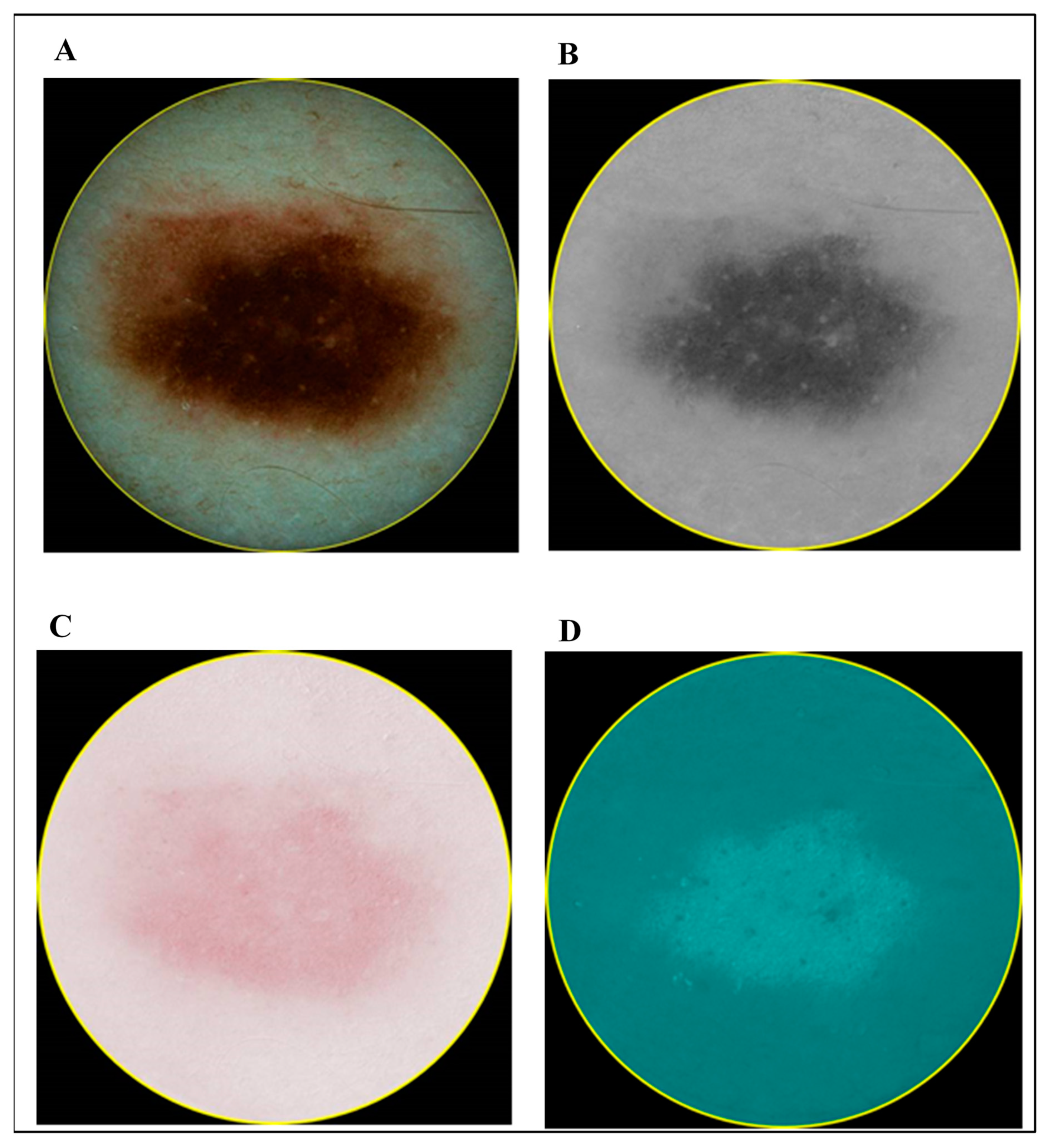 Diagnostics 10 00632 g004