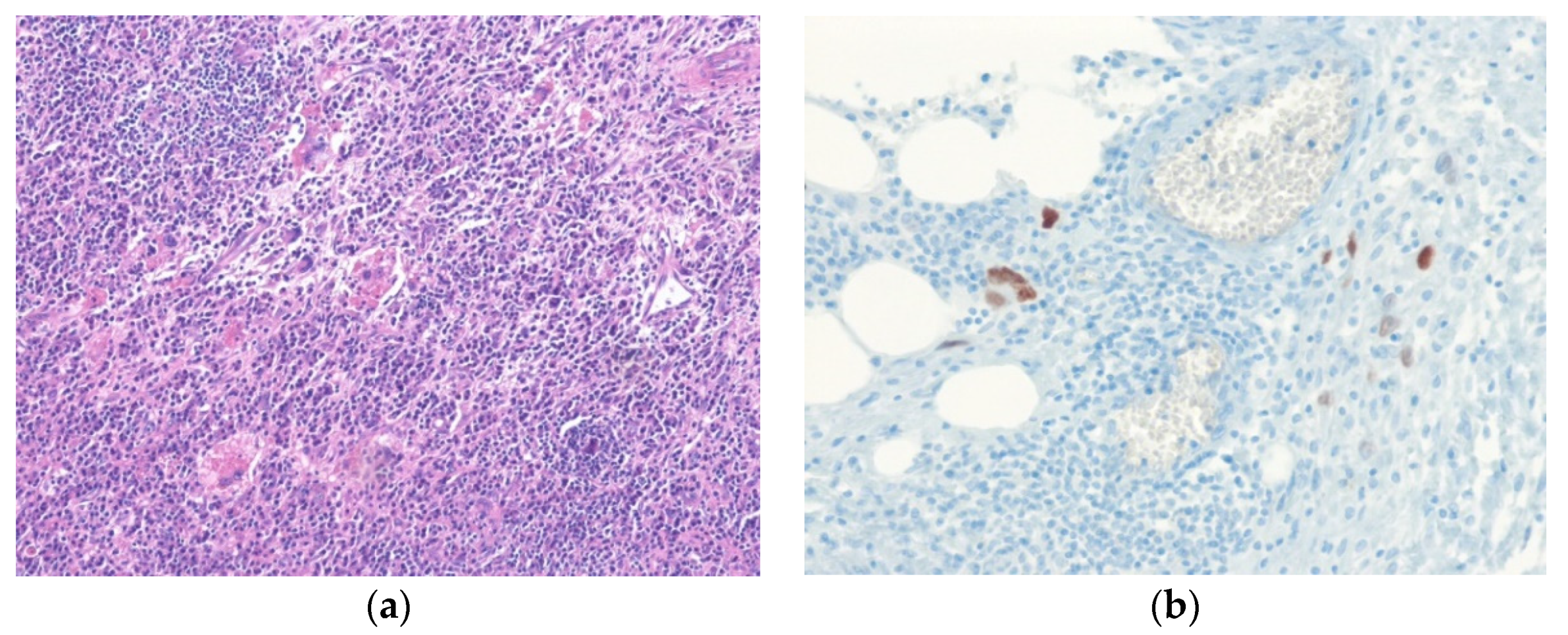 Diagnostics 10 00642 g001