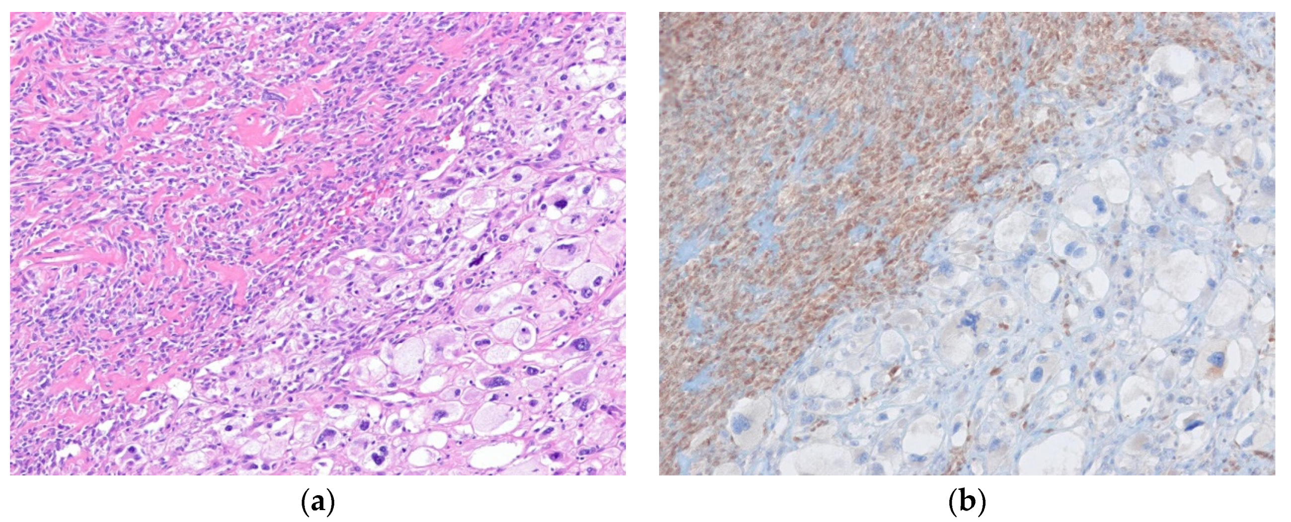 Diagnostics 10 00642 g005