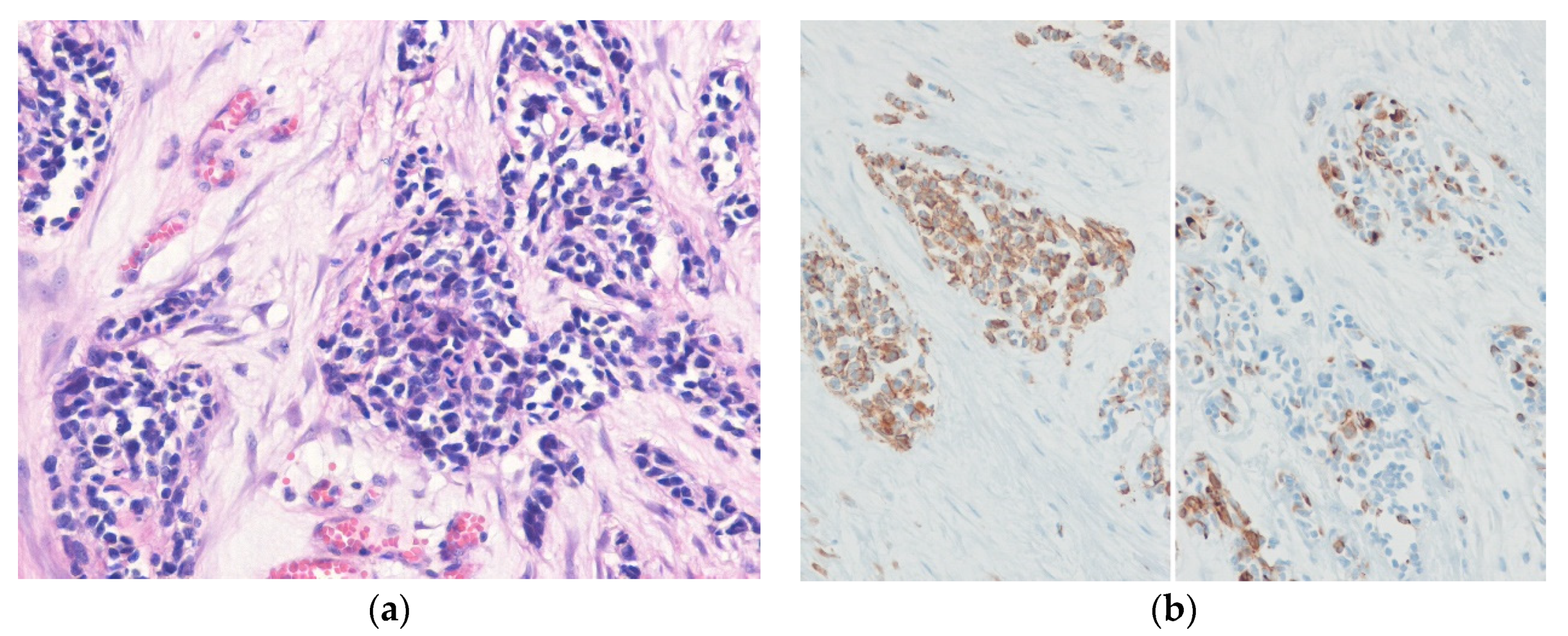 Diagnostics 10 00642 g011