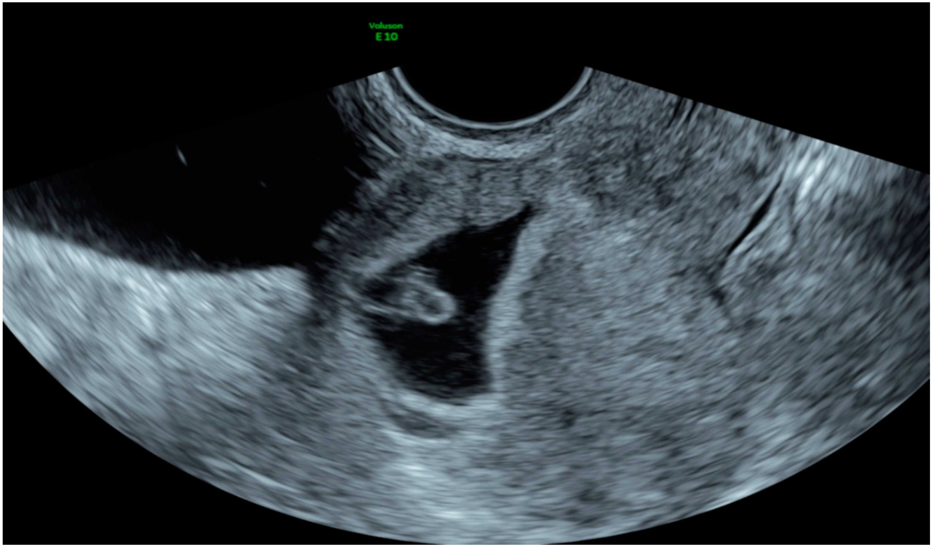 Diagnostics 10 00652 g004