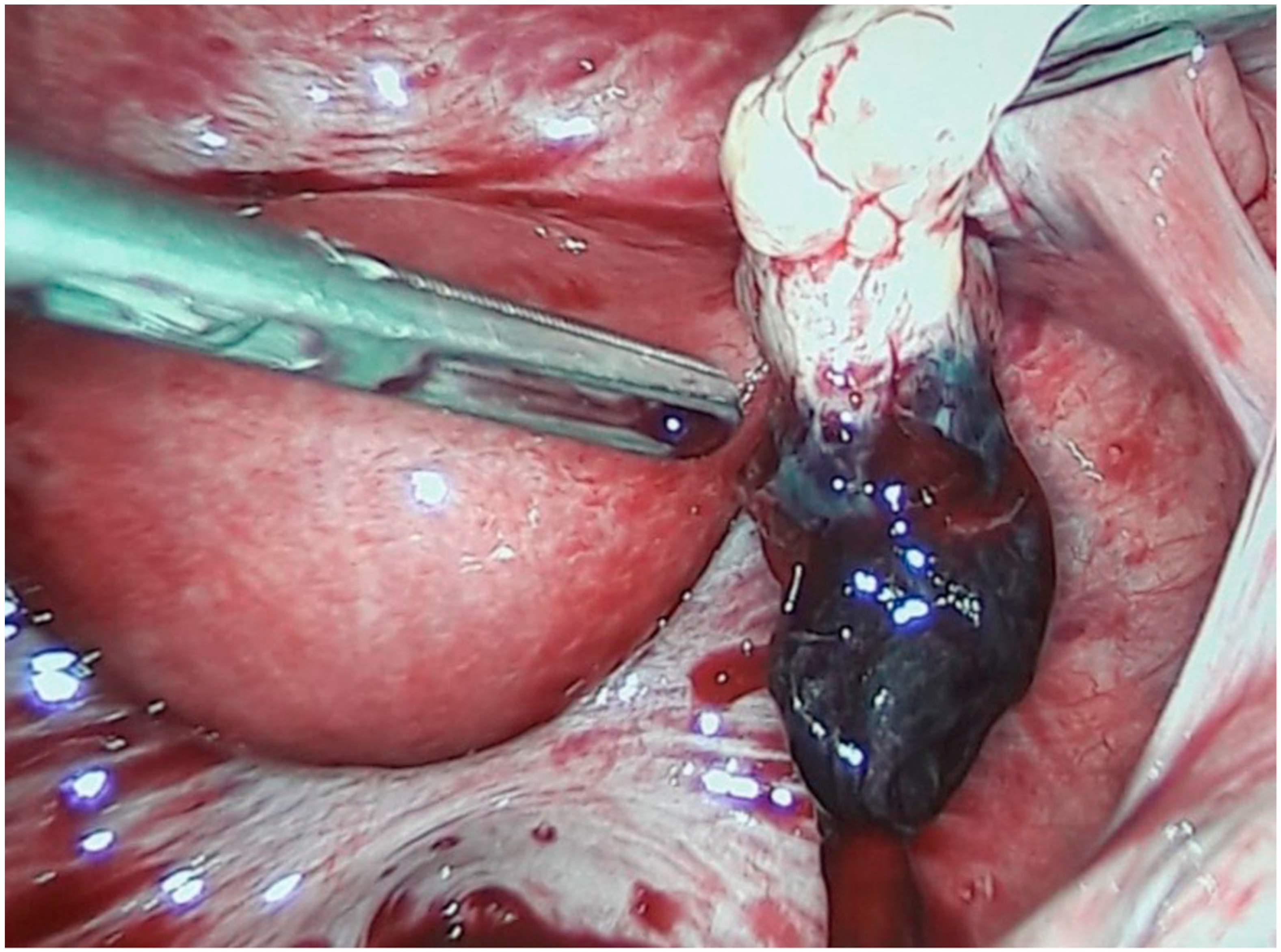 Diagnostics 10 00652 g005