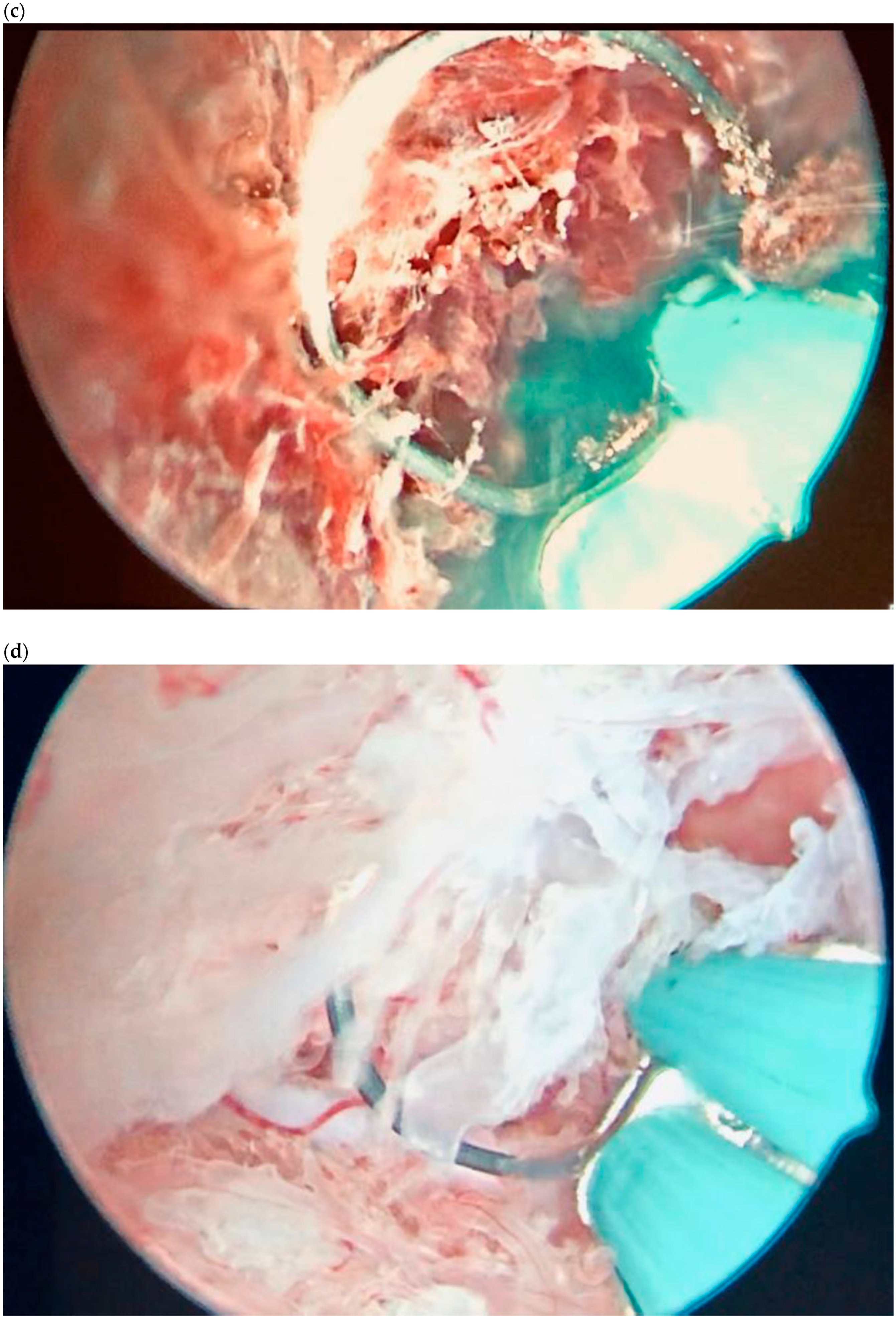 Diagnostics 10 00652 g006b