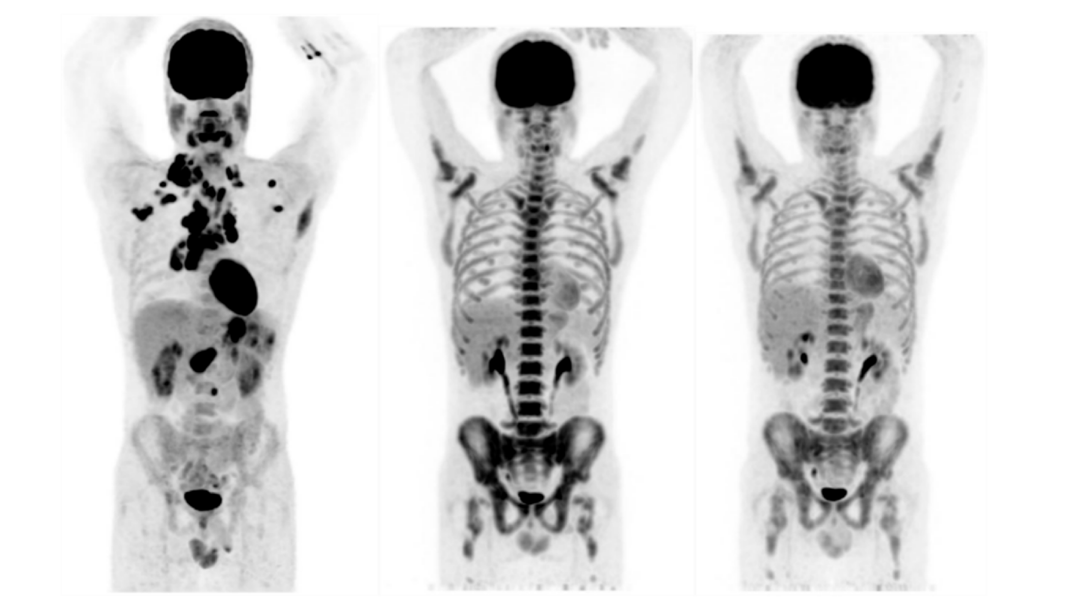 Diagnostics 10 00702 g002 Diagnostics 10 00702 g002
