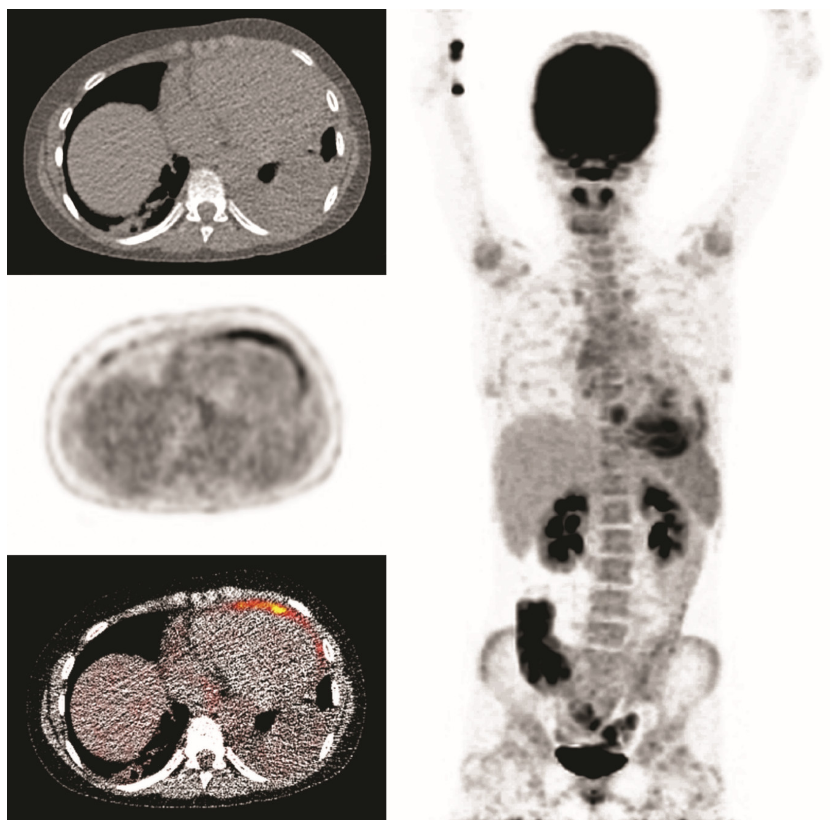 Diagnostics 10 00715 g005 Diagnostics 10 00715 g005