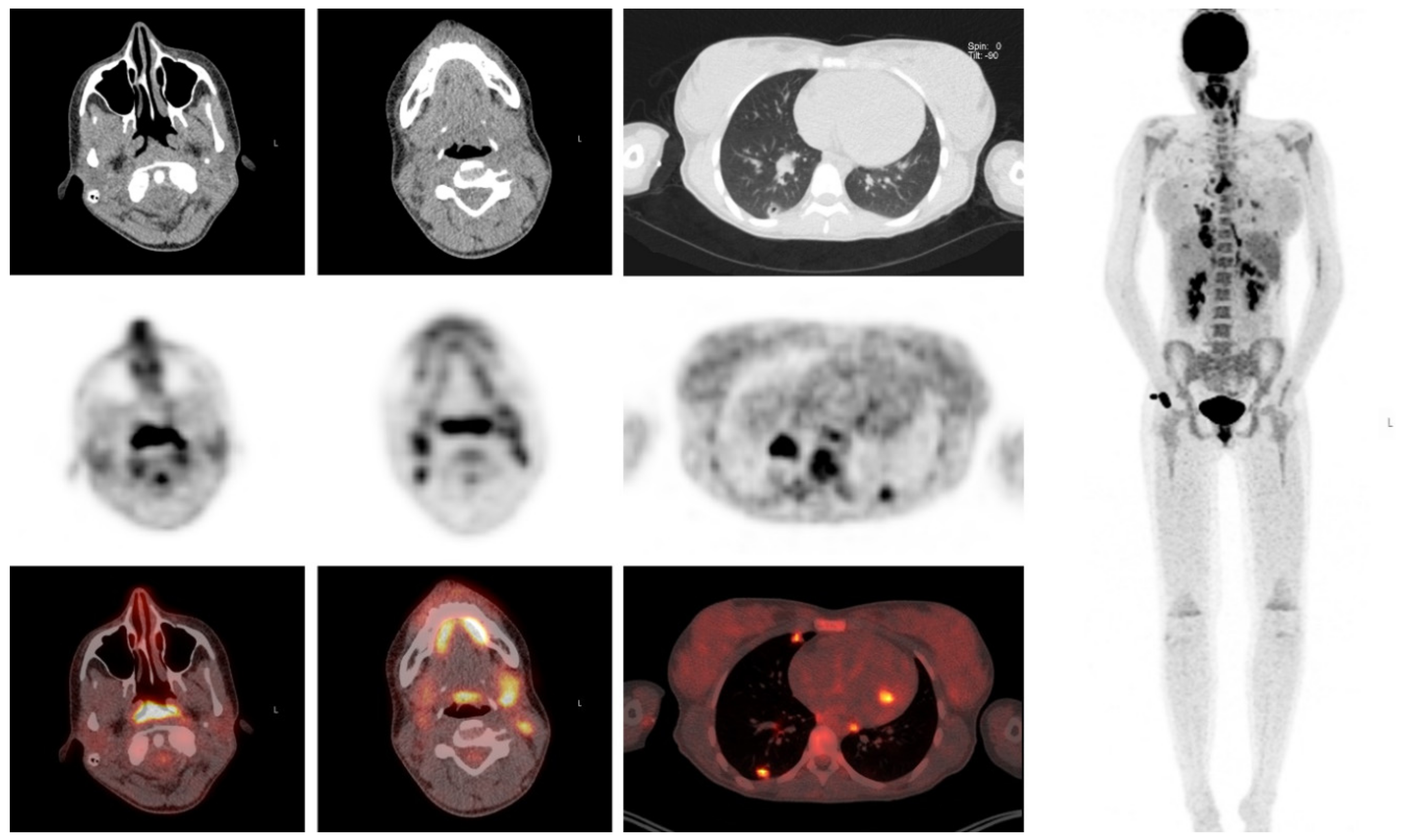 Diagnostics 10 00715 g006 Diagnostics 10 00715 g006