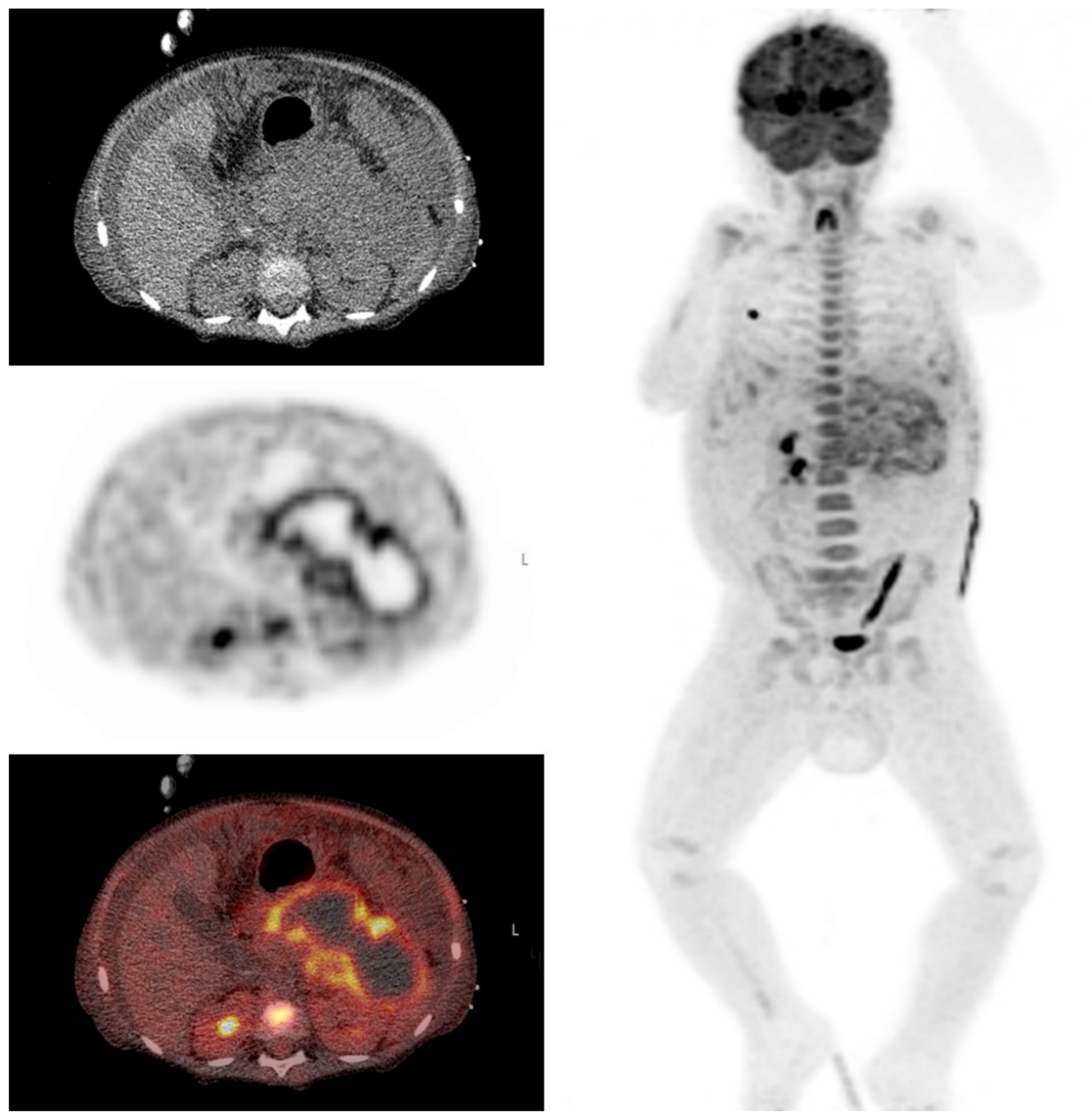 Diagnostics 10 00715 g007 Diagnostics 10 00715 g007