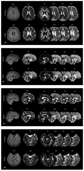 Diagnostics 10 00720 g0a1