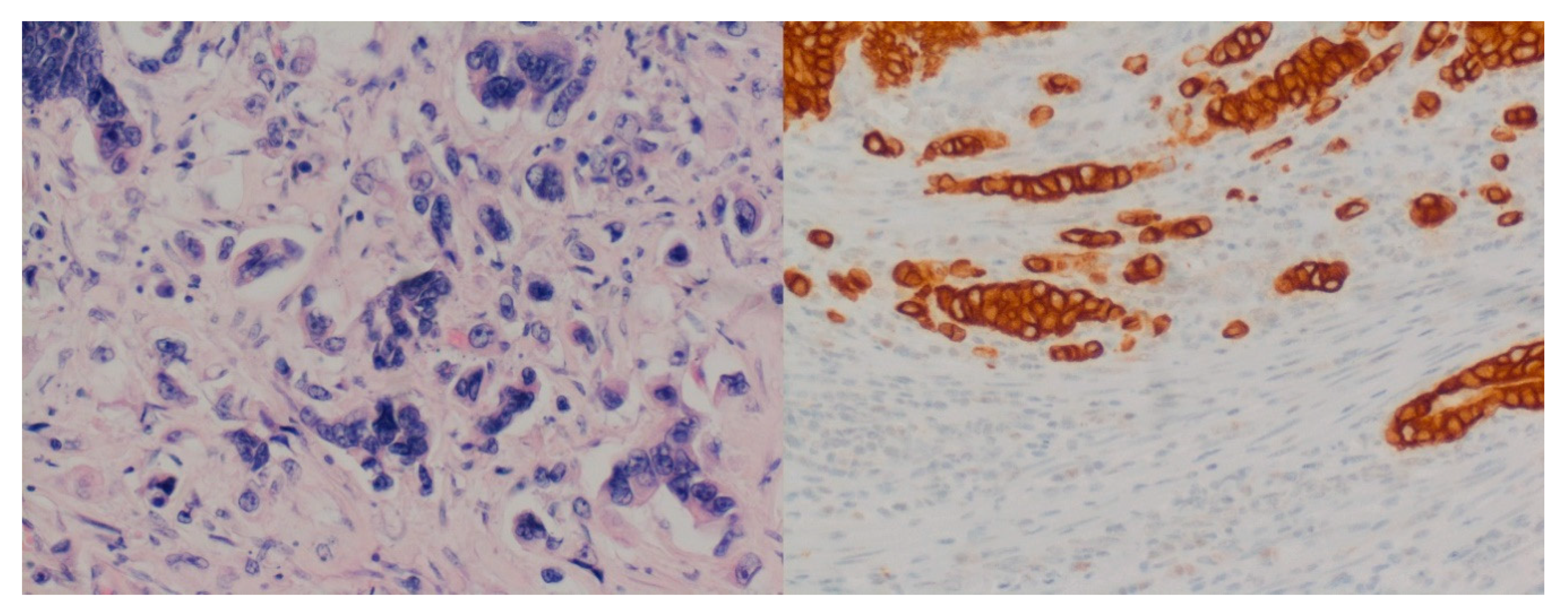 Diagnostics 10 00730 g001