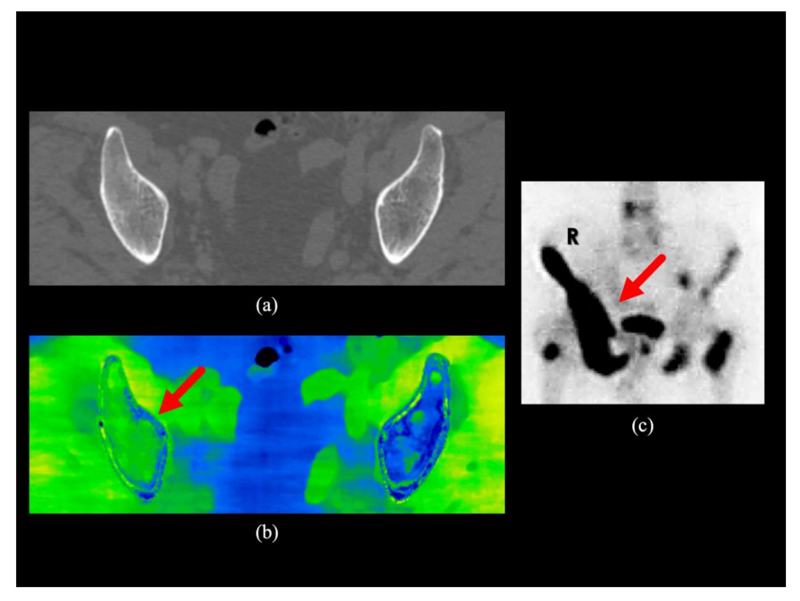 Diagnostics 10 00853 g003