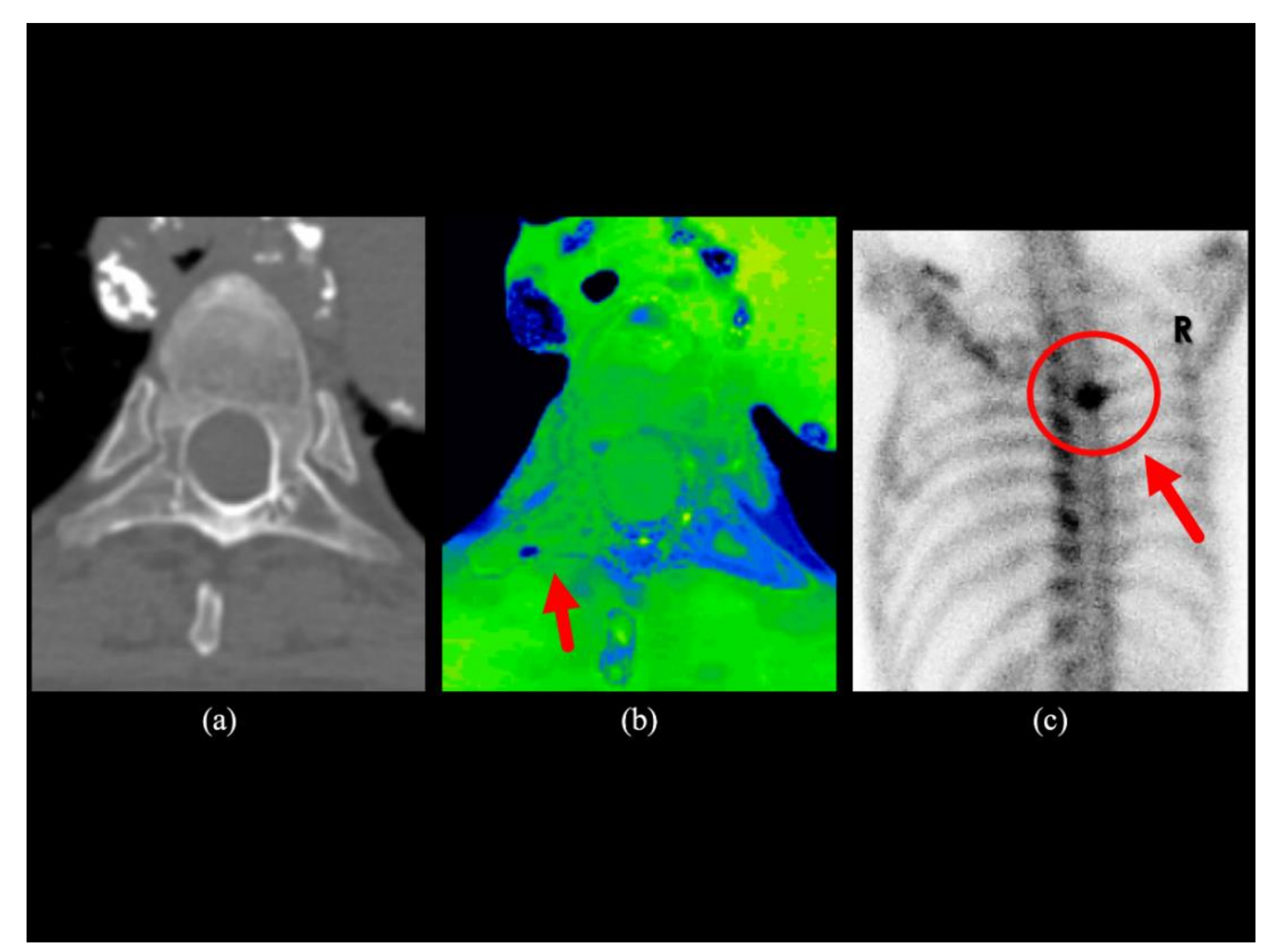 Diagnostics 10 00853 g004