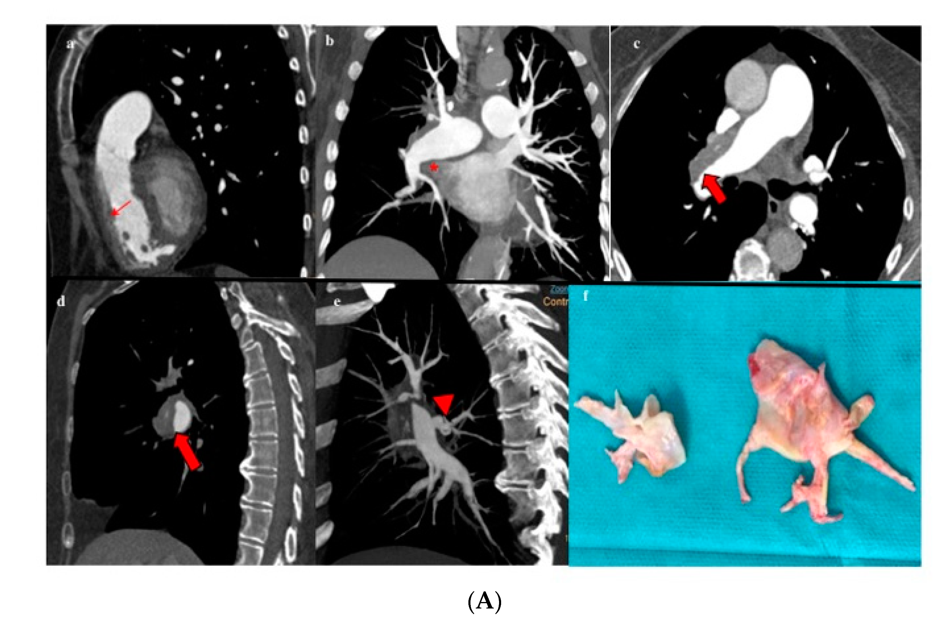 Diagnostics 10 00855 g005a