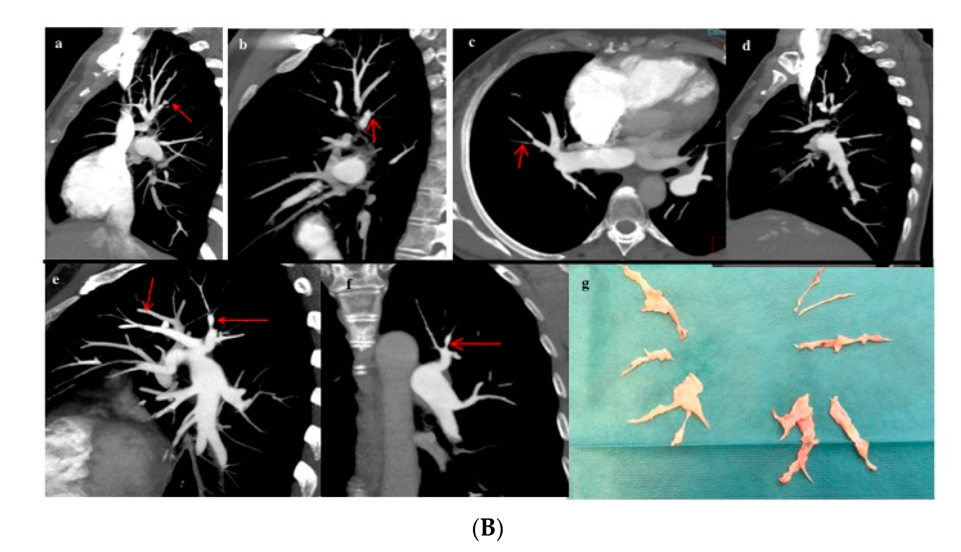 Diagnostics 10 00855 g005b