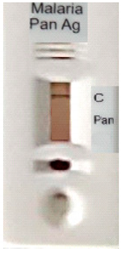 Diagnostics 10 00880 i015