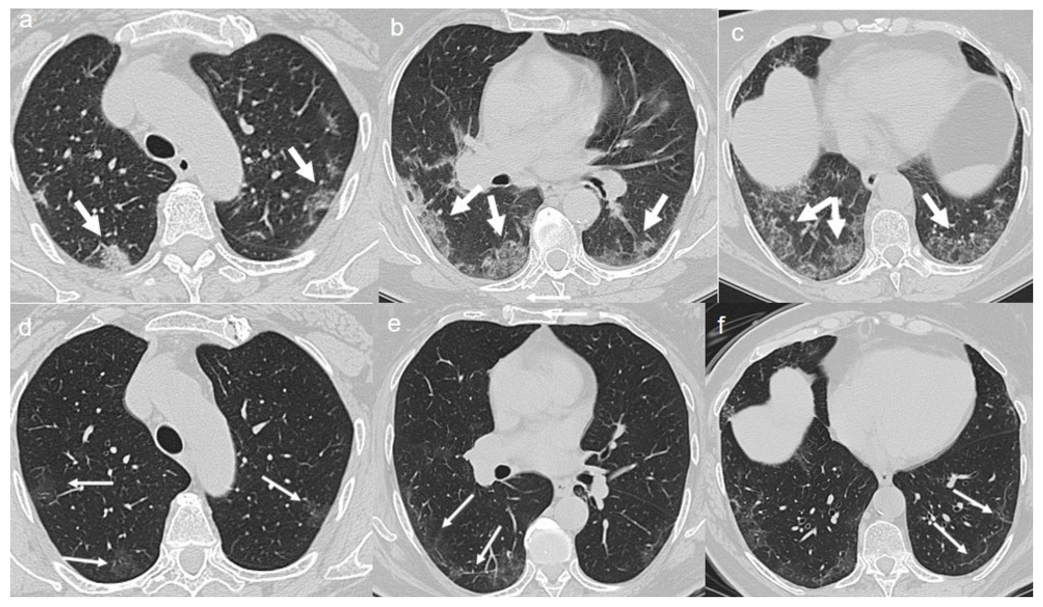 Diagnostics 10 00899 g003 Diagnostics 10 00899 g003