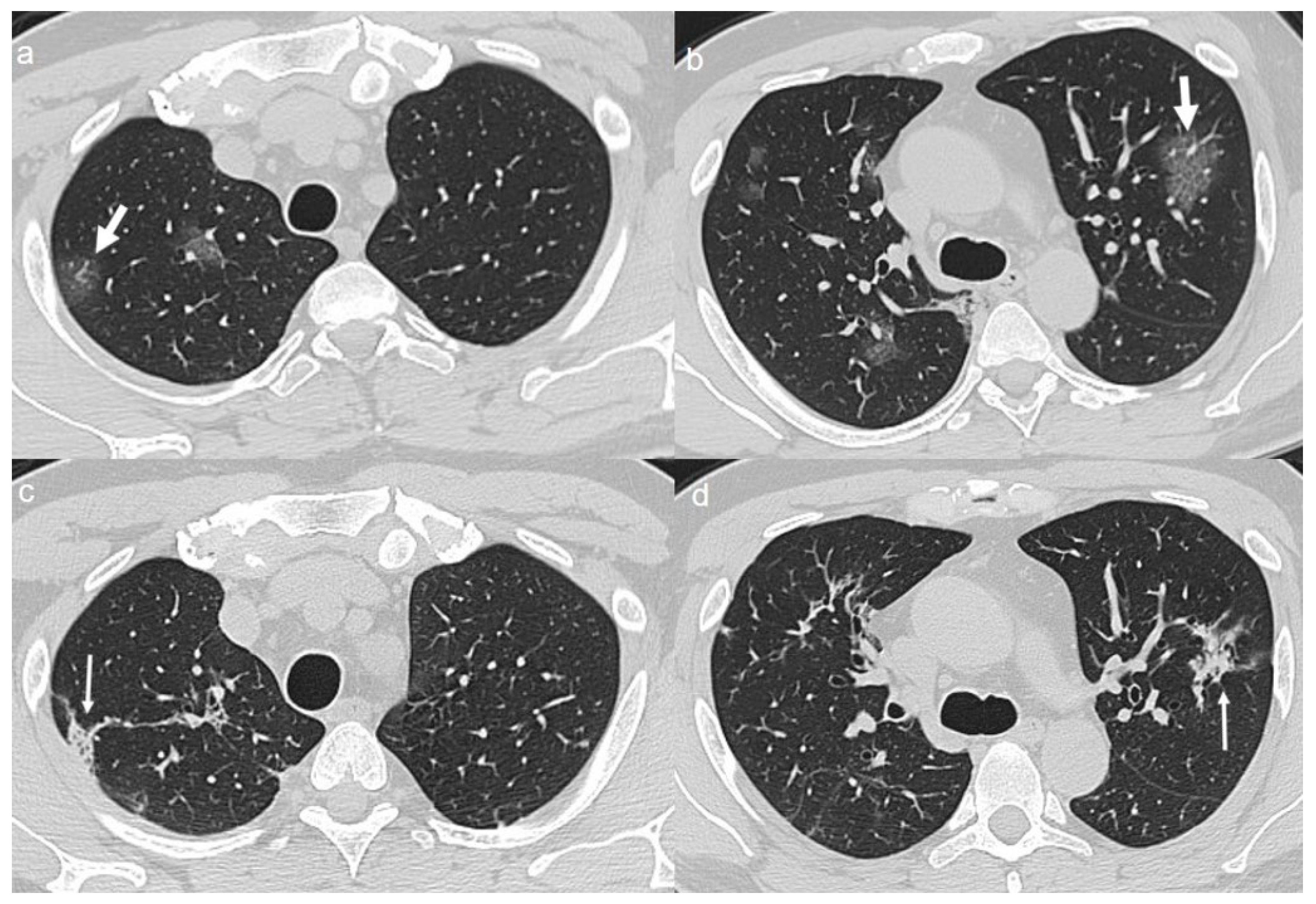 Diagnostics 10 00899 g004 Diagnostics 10 00899 g004