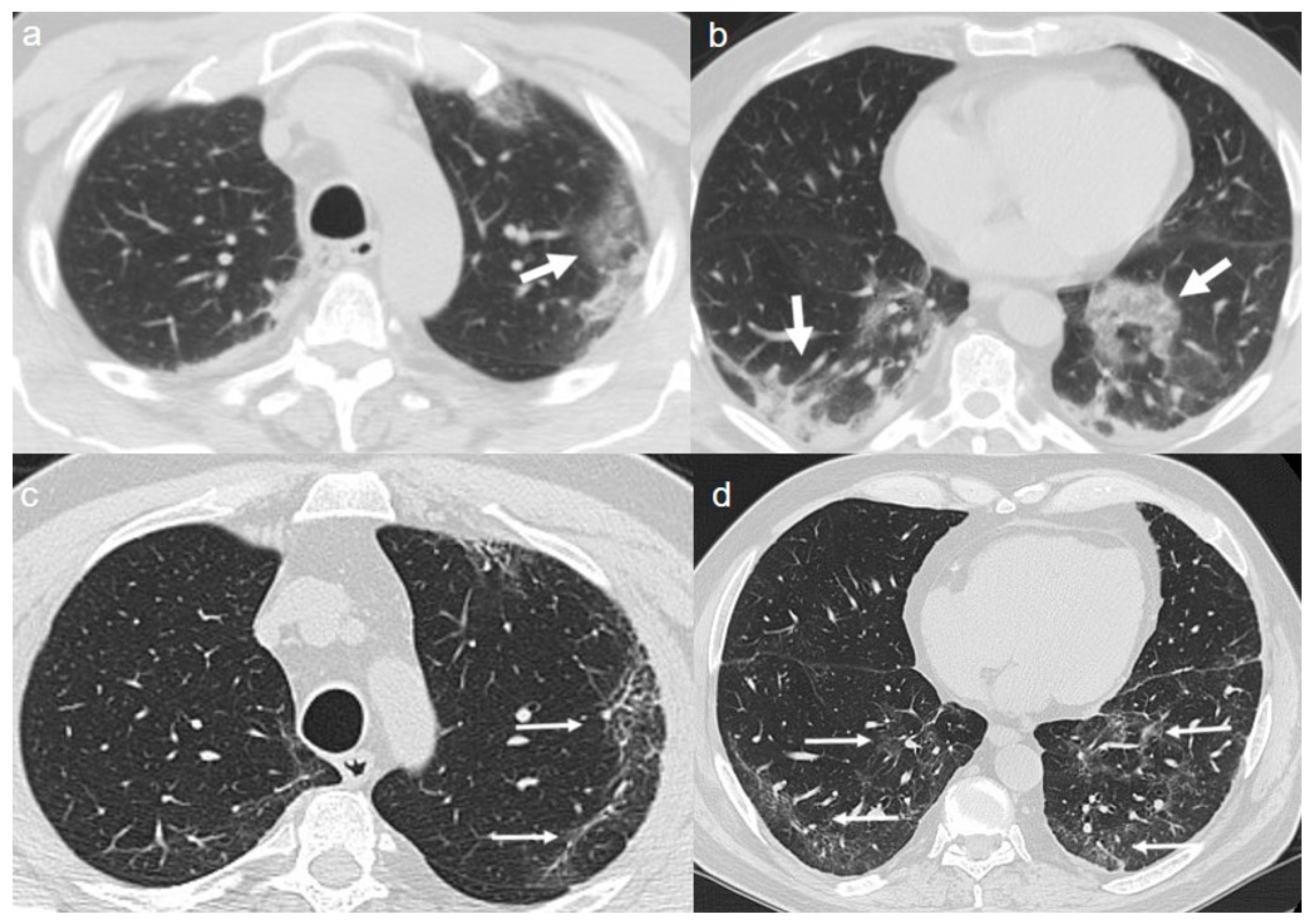 Diagnostics 10 00899 g006 Diagnostics 10 00899 g006