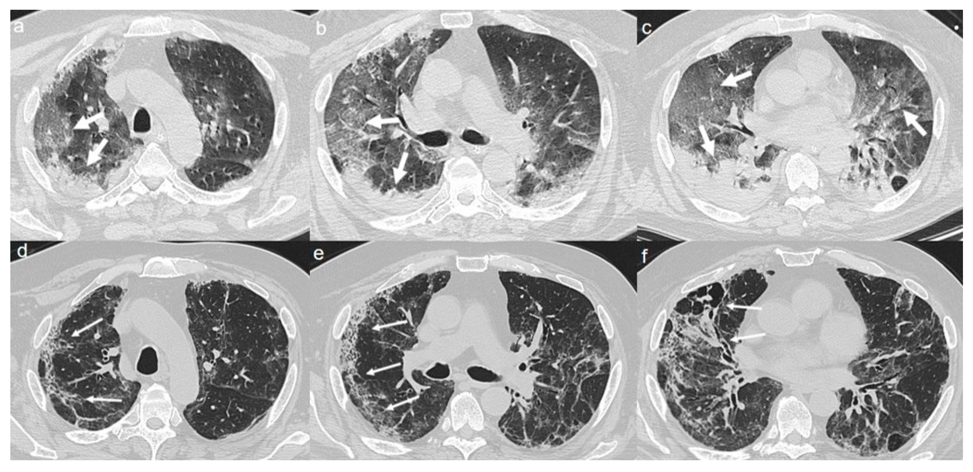 Diagnostics 10 00899 g007 Diagnostics 10 00899 g007