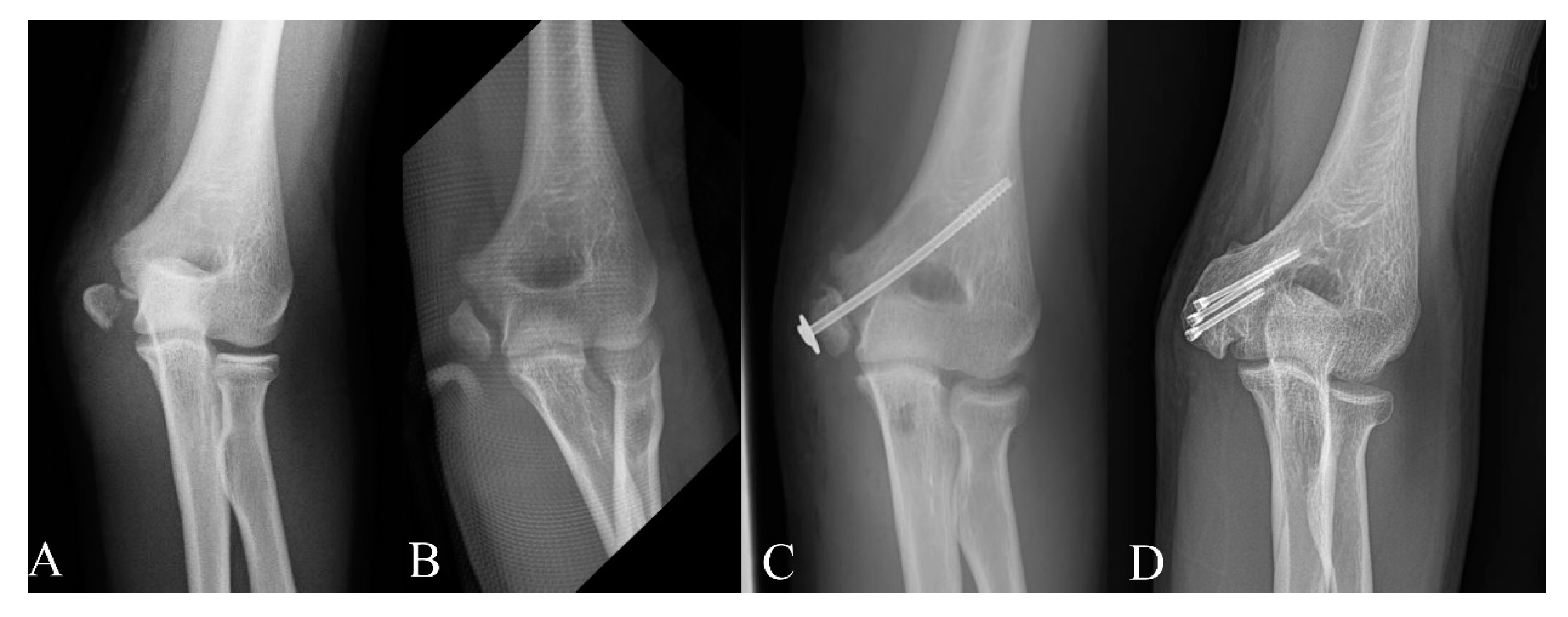 Diagnostics 10 00957 g003