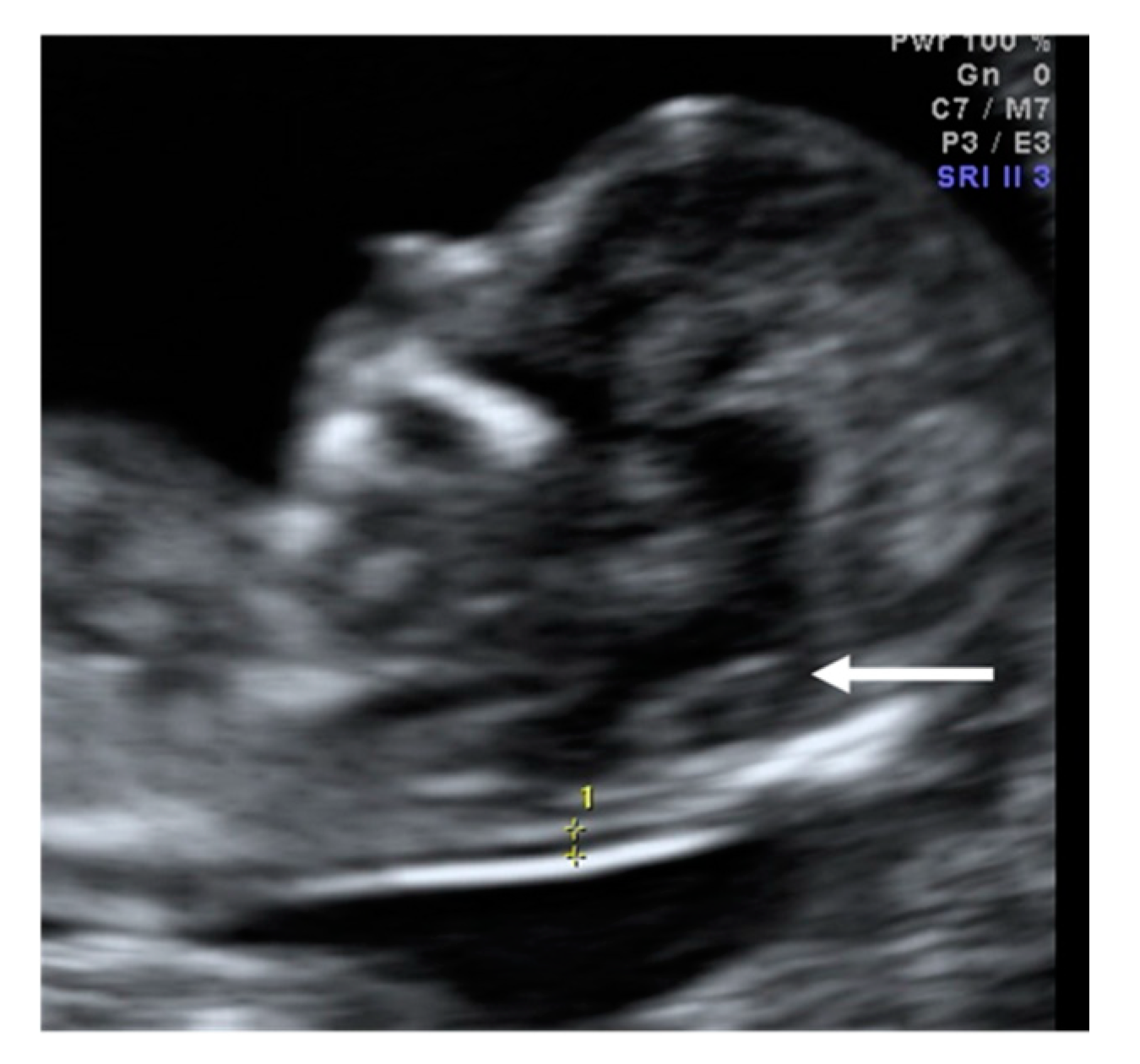 Diagnostics 10 00986 g006