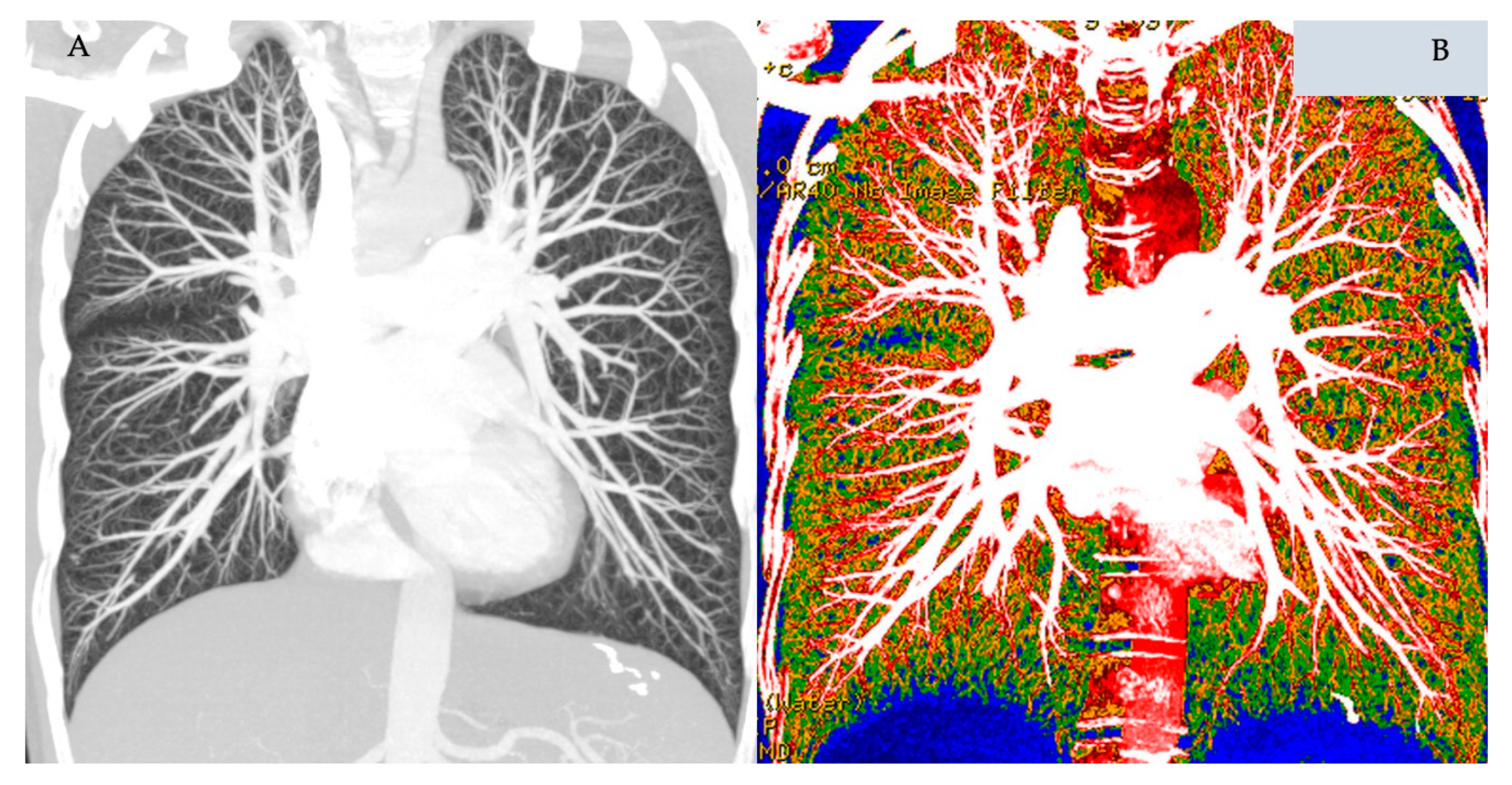 Diagnostics 10 01004 g004
