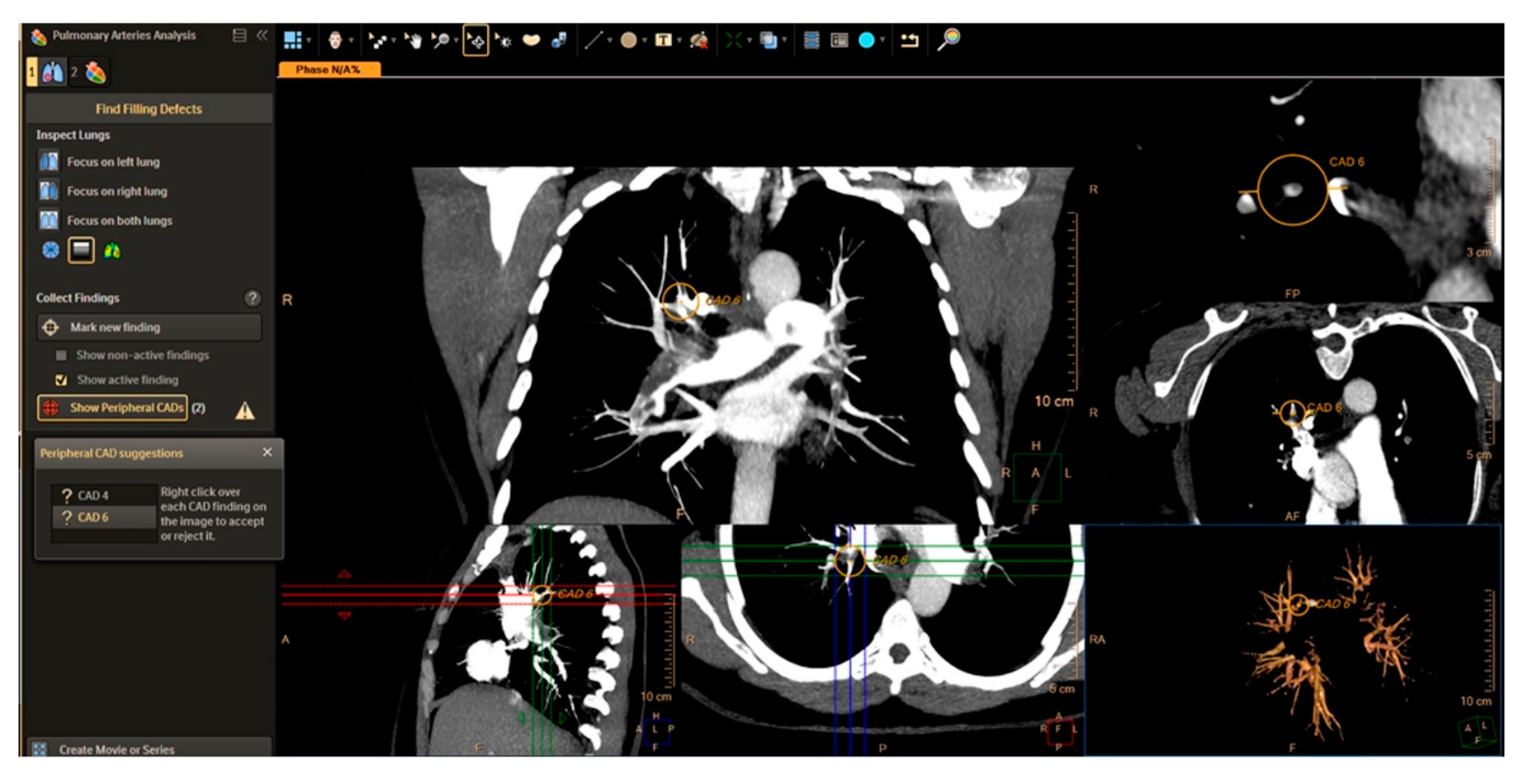 Diagnostics 10 01004 g009
