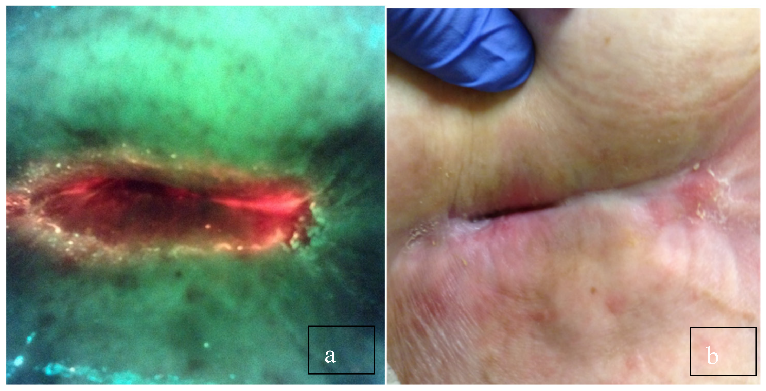 Diagnostics 10 01010 g001 Diagnostics 10 01010 g001