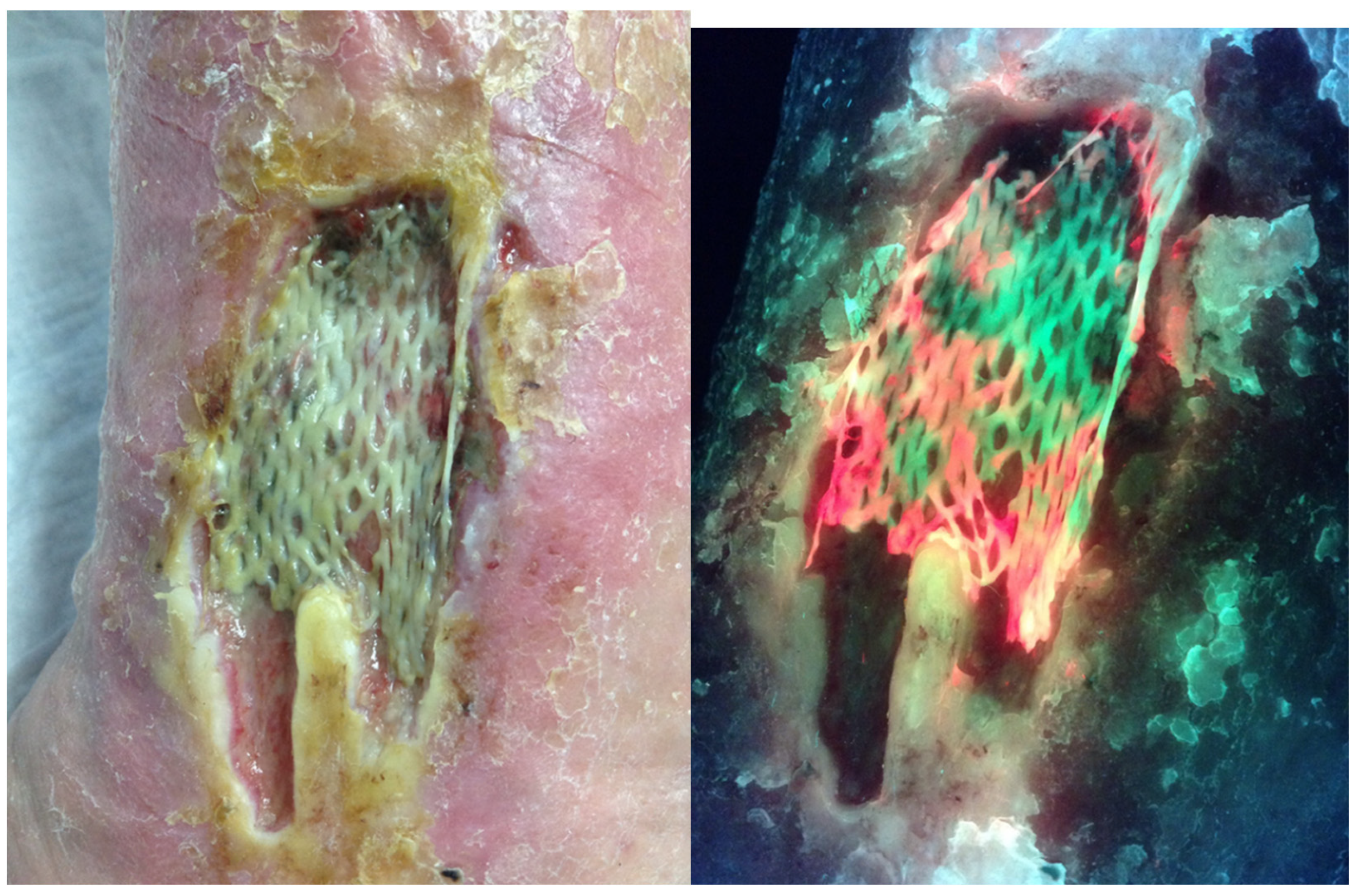 Diagnostics 10 01010 g003 Diagnostics 10 01010 g003