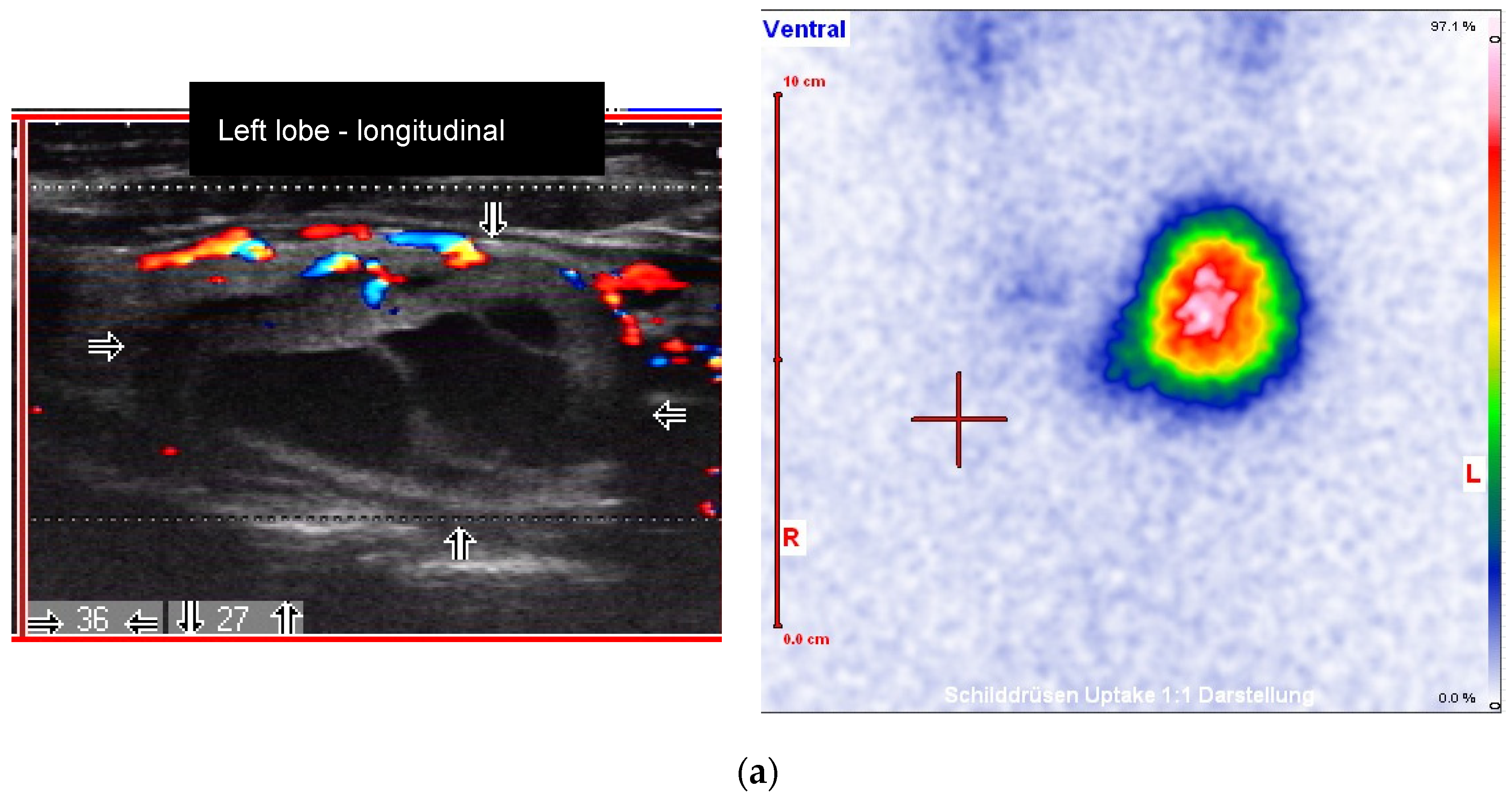 Diagnostics 10 01038 g003a Diagnostics 10 01038 g003a