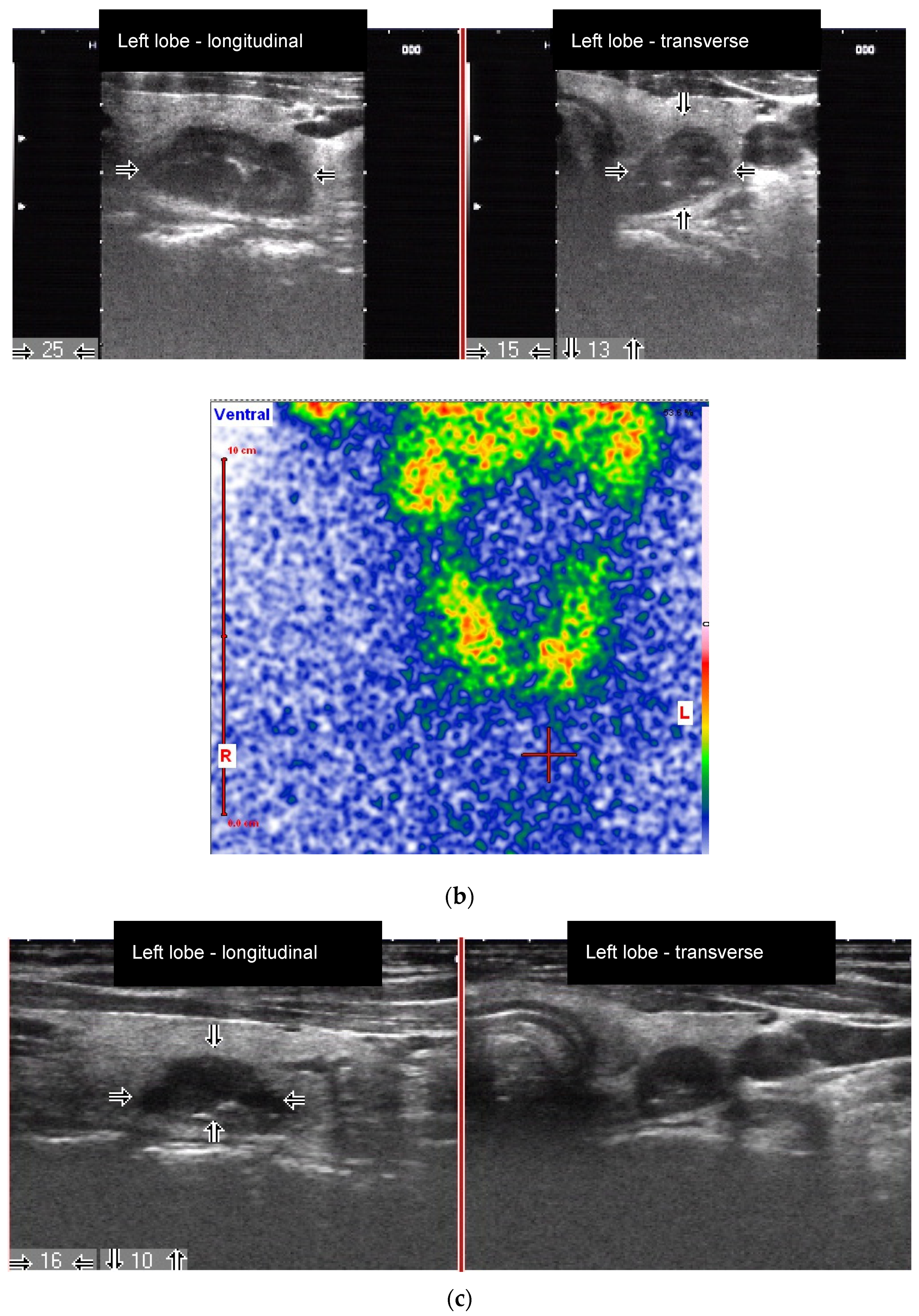Diagnostics 10 01038 g003b Diagnostics 10 01038 g003b