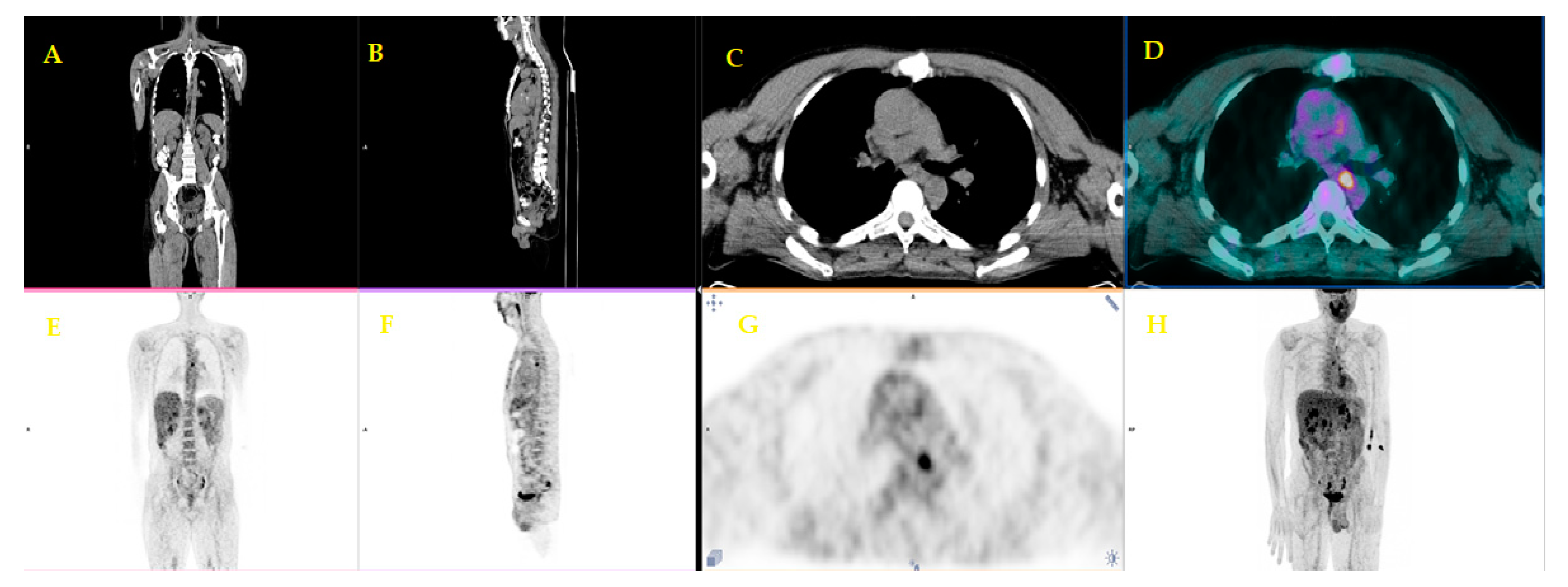 Diagnostics 10 01042 g005