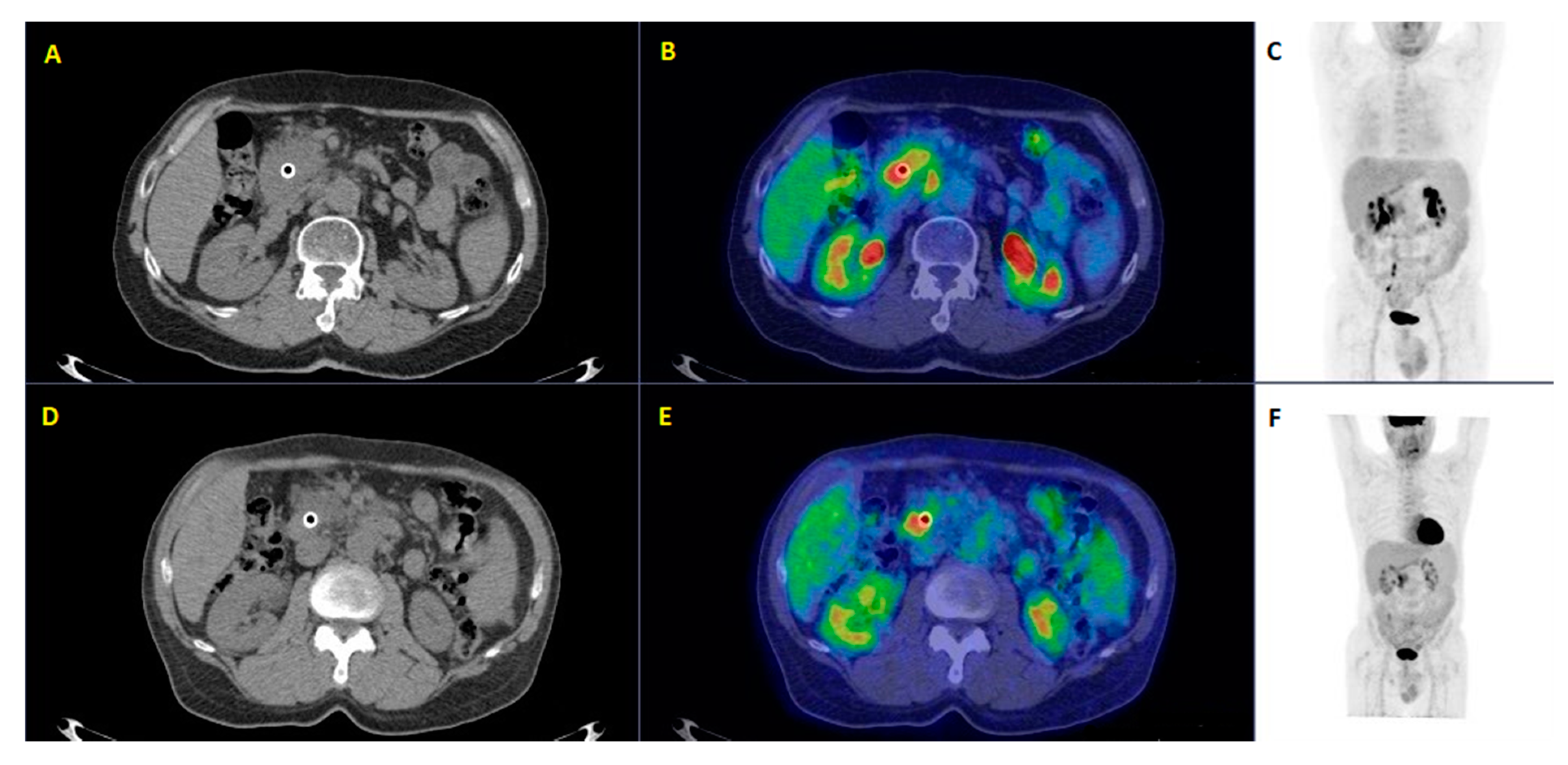 Diagnostics 10 01042 g006